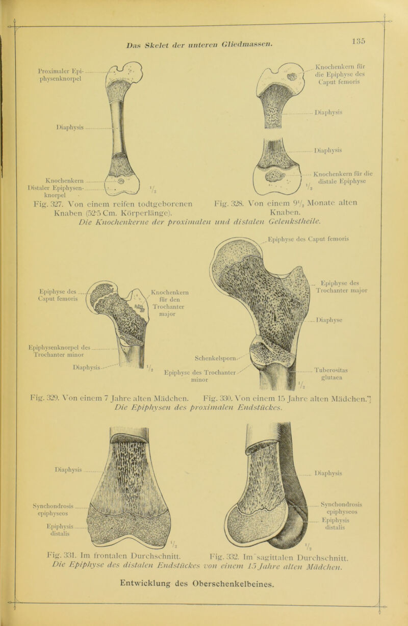 I )iaphysis Proximaler Epi- physenknorpel Knochenkern für die Epiphyse des Caput femoris Diaphysis Diaphysis Knochenkern für die distale Epiphyse Knochenkern Distaler Epiphysen- knorpel Fig. 327. Von einem reifen todtgeborenen Fig. 328. Von einem 9‘/2 Monate alten Knaben (52f> Cm. Körperlänge). Knaben. Die Knochenkerne der proximalen und distalen Gelenkstheile. Epiphyse des Caput femoris Epiphyse des ... Caput femoris Knochenkern für den Trochanter major .. Epiphyse des Trochanter major ..._ I )iaphyse Epiphysenknorpel des Trochanter minor Diaphysis-- Schenkelspom'-'' Epiphyse des Trochanter V minor ... .. Tuberositas glutaea V» Fig. 329. Von einem 7 Jahre alten Mädchen. Fig. 330. Von einem 15 Jahre alten Mädchen; Die Epiphysen des proximalen Endstückes. I )iaphysis Synchondrosis epiphyseos Epiphysis. distalis Fig. 331. Im frontalen Durchschnitt. Die Epiphyse des distalen Endstückes 1 »iaphysis ... Synchondrosis epiphyseos ... Epiphysis distalis Fig. 332. Im sagittalen Durchschnitt. von einem 15 Jahre allen Mädchen. Entwicklung des Oberschenkelbeines.