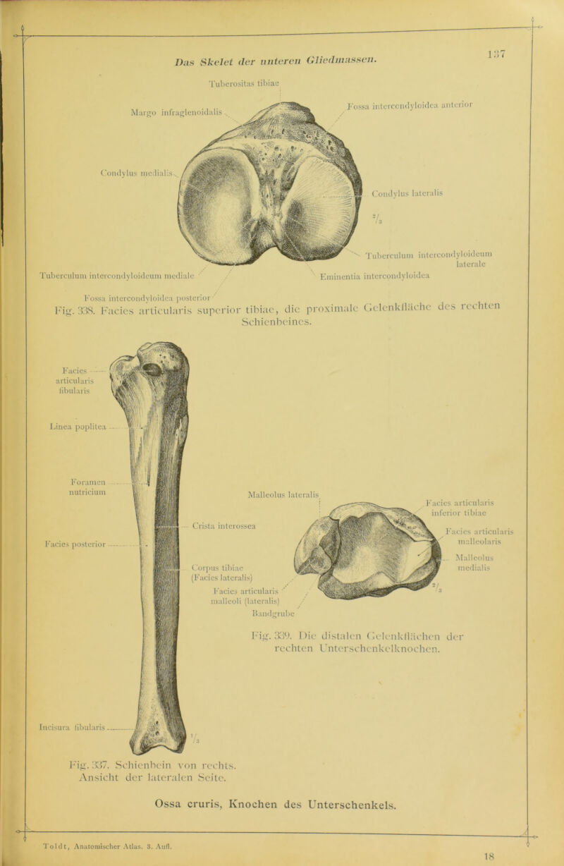 f Das Skelet der unteren Gliedmassen. Tuberositas tibiae Fossa intercondyloidca anterior 137 Margo infraglenoidalis. Condylus medialis... Condylus lateralis -L Tuberculum intercondyloidcum mediale Tuberculum intercondyloideum laterale Eminentia intercondyloidca Fossa intercondyloidca posterior Fig. 338. Facies articularis superior tibiae, die proximale Gelenklläche des 1 echten Schienbeines. Facies - articularis iibularis & Linea poplitea Foramen nutricium Facies posterior Incisura Iibularis Malleolus lateralis - Crista interossea Corpus tibiae (Facies lateralis) Facies articularis malleoli (lateralis) Bandgrubc F acies articularis inferior tibiae Facies articularis malleolaris .. Malleolus mediaüs Fig. 339. Die distalen Gelenkllächen der rechten Unterschcnkclknochcn. dg. 337. Schienbein von rechts. Ansicht der lateralen Seite. Ossa cruris, Knochen des Unterschenkels. Toi dt, Anatomischer Atlas. 3. Aufl. 18