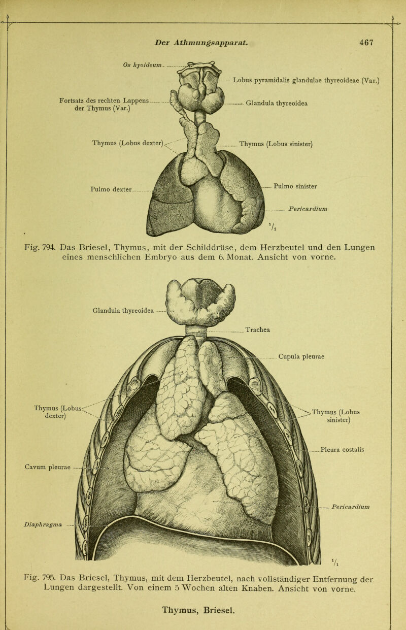 Pulmo dexter Os hyoideum - Fortsatz des rechten Lappens — der Thymus (Var.) Lobus pyramidalis glandulae thyreoideae (Var. Glandula thyreoidea Thymus (Lobus dexter) Thymus (Lobus sinister) Pulmo sinister Pericar dium Fig. 794. Das Briesel, Thymus, mit der Schilddrüse, dem Herzbeutel und den Lungen eines menschlichen Embryo aus dem 6. Monat. Ansicht von vorne. Thymus dexter) Thymus (Lobus sinister) Glandula thyreoidea Trachea Cupula pleurae Pleura costalis Cavum pleurae Pericardium Diaphragma, Fig. 795. Das Briesel, Thymus, mit dem Herzbeutel, nach vollständiger Entfernung der Lungen dargestellt. Von einem 5 Wochen alten Knaben. Ansicht von vorne. Thymus, Briesel.