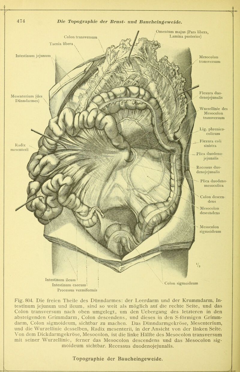 ,, -e> Mesenterium (des Dünndarmes) Radix v mesenterii Intestinum ileum Intestinum caecum > J Processus vermiformis Omentum majus (Pars libera, Lamina posterior) Mesocolon ' transversum Colon transversum Taenia libera Intestinum jejunum Flexura duo- denojejunalis Wurzellinie des Mesocolon transversum Colon descen- dens Mesocolon descendens Mesocolon sigmoideum Colon sigmoideum Lig. phrenico- colicum Flexura coli sinistra Plica duodeno- jejunalis Recessus duo- denojejunalis Plica duodeno- mesocolica Fig. 804. Die freien Theile des Dünndarmes: der Leerdarm und der Krummdarm, In- testinum jejunum und ileum, sind so weit als möglich auf die rechte Seite, und das Colon transversum nach oben umgelegt, um den Uebergang des letzteren in den absteigenden Grimmdarm, Colon descendens, und dieses in den S-förmigen Grimm- darm, Colon sigmoideum, sichtbar zu machen. Das Dünndarmgekröse, Mesenterium, und die Wurzellinie desselben, Radix mesenterii, in der Ansicht von der linken Seite. Von dem Dickdarmgekröse, Mesocolon, ist die linke Hälfte des Mesocolon transversum mit seiner Wurzellinie, ferner das Mesocolon descendens und das Mesocolon sig- moideum sichtbar. Recessus duodenojejunalis.