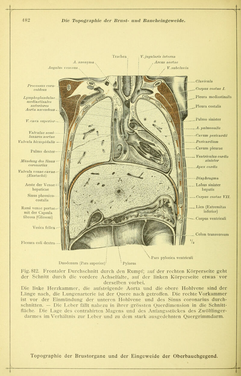 A. anonyma < Angulus venosus „ V. cava superior Mündung des Sinus coronarius Valvula venae cavae (Eustachii) Aeste der Venae hepaticae Sinus phrenico- costalis Rami venae portae mit der Capsula fibrosa (Glissoni) Vesica fellea Flexura coli dextra Trachea V.jugularis interna , Arcus aortae / y V. subclavia Pleura costalis Pulmo sinister A. pulmonalis Cavum pericardii Pericardi um Cavum pleurae Ventriculus cordis sinister cordis Pulmo Clavicula Corpus costae I. Pleura mediastinalis Lobus sinister hepatis Coi'pus costae VII. Lien (Extremitas inferior) Corpus ventriculi Colon transversum Processus cora- - coideus Lymph oglan dulae ;- medias tinales an teriores Aorta ascendens - Valvulae semi- - lunares aortae Valvula bicuspidalis - Duodenum (Pars superior) ' Pylorus \Pars pylorica ventriculi Fig. 812. Frontaler Durchschnitt durch den Rumpf; auf der rechten Körperseite geht der Schnitt durch die vordere Achselfalte, auf der linken Körperseite etwas vor derselben vorbei. Die linke Herzkammer, die aufsteigende Aorta und die obere Hohlvene sind der Länge nach, die Lungenarterie ist der Quere nach getroffen. Die rechte Vorkammer ist vor der Einmündung der unteren Hohlvene und des Sinus coronarius durch- schnitten. — Die Leber fällt nahezu in ihrer grössten Querdimension in die Schnitt- fläche. Die Lage des contrahirten Magens und des Anfangsstückes des Zwölffinger- darmes im Verhältnis zur Leber und zu dem stark ausgedehnten Quergrimmdarm.