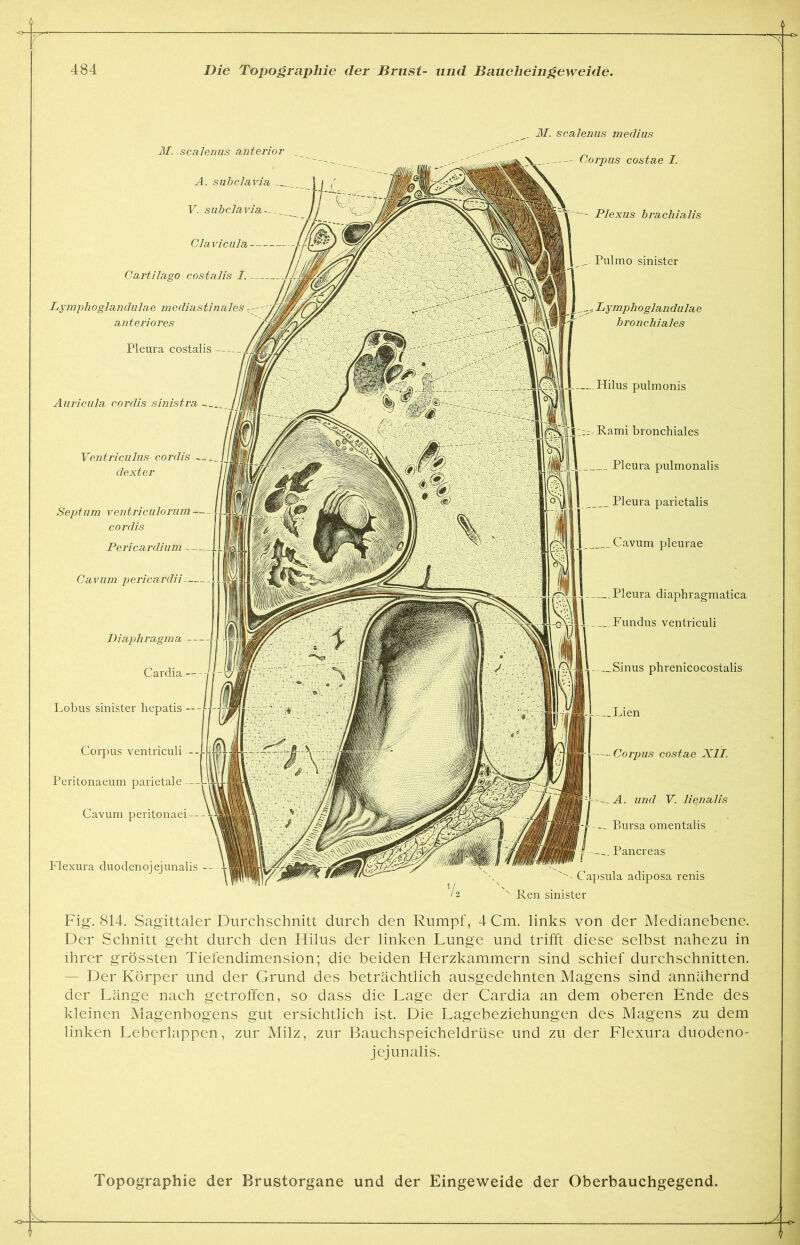 M. scalenus medius M. scalenus anterior _ A. subclavia V. subclavia- Clavicula — Cartilago costalis I. _ Lymphoglandiilae mediastinales anterioi'es Pleura costalis Plexus brachialis Pulmo sinister Lymphoglandulae bronchiales Hilus pulmonis Rami bronchiales __ Pleura pulmonalis Pleura parietalis Cavum pleurae — Pleura diaphragmatica Fundus ventriculi Sinus phrenicocostalis Lien Corpus costae XII. A. und V. lienalis — Bursa omentalis — Pancreas Capsula adiposa renis x Ren sinister Anricula cordis sinistra — Diaphragma - Cardia - Lobus sinister hepatis - Corpus ventriculi --- Peritonaeum parietale — Cavum peritonaei — Corpus costae I. Ventriculus cordis dexter Septum ventriculorum cordis Pericardium ~ Cavum pericardii- Flexura duodenojejunalis Fig. 814. Sagittaler Durchschnitt durch den Rumpf, 4 Cm. links von der Medianebene. Der Schnitt geht durch den Hilus der linken Lunge und trifft diese selbst nahezu in ihrer grössten Tiefendimension; die beiden Herzkammern sind schief durchschnitten. - Der Körper und der Grund des beträchtlich ausgedehnten Magens sind annähernd der Länge nach getroffen, so dass die Lage der Cardia an dem oberen Ende des kleinen Magenbogens gut ersichtlich ist. Die Lagebeziehungen des Magens zu dem linken Leberlappen, zur Milz, zur Bauchspeicheldrüse und zu der Flexura duodeno- jejunalis. 11