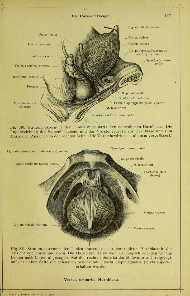 Intestinum rectum Ureter dexter Ductus deferens — Fundus vesicae — Vesicula seminalis dextra Prostata M. sphincter ani externus - Lig. umbilicale medium Vertex vesicae Corpus vesicae Lig. puboprostaticum (pubo- vesicale) medium Symphysis ossiuni pubis Ramus inferior ossis ischii M. pubovesicalis M. obturator internus v Fascia diaphragmatis pelvis superior M. levator ani Fig. 840. Stratum externum der Tunica muscularis der contrahirten Harnblase. Die Lagebeziehung des Samenbläschens und der Vorsteherdrüse zur Harnblase und zum Mastdarm. Ansicht von der rechten Seite. (Die Vorsteherdrüse ist abnorm vergrössert.) Lig. puboprostaticum (pubovesicale) medium Arcus tendineus fasciae pelvis M. pubovesicalis M. levator ani Prostata (Lobus dexter) Lig. u'mbilicale medium Corpus vesicae Vertex vesicae Symphysis ossium pubis Fig. 841. Stratum externum der Tunica muscularis der contrahirten Harnblase in der Ansicht von vorne und oben. Die Harnblase ist so weit als möglich von den Scham- beinen nach hinten abgezogen. Auf der rechten Seite ist der M. levator ani freigelegt, auf der linken Seite die denselben bedeckende Fascia diaphragmatis pelvis superior erhalten worden. Vesica urinaria, Harnblase. -€> -€> Toldt, Anatomischer Atlas. 3. Aufl.