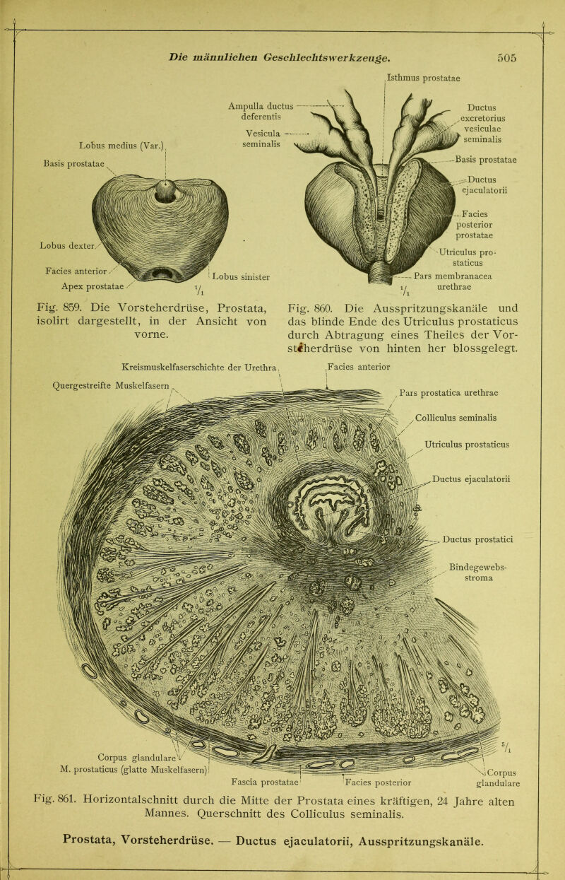 , Isthmus prostatae Lobus medius (Var.) Basis prostatae Ampulla ductus deferentis Vesicula — seminalis Lobus sinister Vi Ductus excretorius vesiculae seminalis -Basis prostatae ejaculatorii Facies posterior prostatae Lobus dexter Facies anterior Apex prostatae Utriculus pro- staticus Pars membranacea 1 j urethrae Fig. 859. Die Vorsteherdrüse, Prostata, isolirt dargestellt, in der Ansicht von vorne. Fig. 860. Die Ausspritzungskanäle und das blinde Ende des Utriculus prostaticus durch Abtragung eines Theiles der Vor- steherdrüse von hinten her blossgelegt. Facies posterior Corpus glanduläre Corpus glanduläre M. prostaticus (glatte Muskelfasern) Fascia prostatae Kreismuskelfaserschichte der Urethra, \ Quergestreifte Muskelfasern .Facies anterior Pars prostatica urethrae Colliculus seminalis Utriculus prostaticus ejaculatorii Ductus prostatici Bindegewebs- stroma Fig. 861. Horizontalschnitt durch die Mitte der Prostata eines kräftigen, 24 Jahre alten Mannes. Querschnitt des Colliculus seminalis. Prostata, Vorsteherdrüse. — Ductus ejaculatorii, Ausspritzungskanäle.