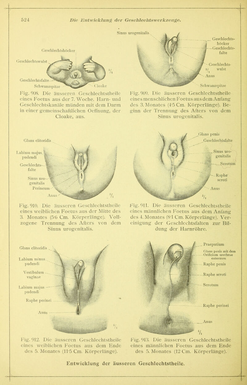 Sinus urogenitalis. Geschlechtshöcker Fig. 908. Die äusseren Geschlechtstheile eines Foetus aus der 7. Woche. Harn- und Geschlechtskanäle münden mit dem Darm in einer gemeinschaftlichen Oeffnung, der Cloake, aus. Glans clitoridis. Fig. 910. Die äusseren Geschlechtstheile eines weiblichen Foetus aus der Mitte des 3. Monates (5*6 Cm. Körperlänge). Voll- zogene Trennung des Afters von dem Sinus urogenitalis. Fig. 909. Die äusseren Geschlechtstheile eines menschlichen Foetus aus dem Anfang des 3. Monates (4'5 Cm. Körperlänge). Be- ginn der Trennung des Afters von dem Sinus urogenitalis. Fig. 911. Die äusseren Geschlechtstheile eines männlichen Foetus aus dem Anfang des 4. Monates (8*1 Cm. Körperlänge). Ver- einigung der Geschlechtsfalten zur Bil- dung der Harnröhre. Glans clitoridis „ Labium minus pudendi Vestibulum vagin ae Labium majus — pudendi Raphe perinei Anus -- Fig. 912. Die äusseren Geschlechtstheile eines weiblichen Foetus aus dem Ende des 5. Monates (1F5 Cm. Körperlänge). Raphe perinei Anus v, Praeputium Glans penis mit dem Orificium urethrae externum Raphe penis scroti Scrotum Fig. 913. Die äusseren Geschlechtstheile eines männlichen Foetus aus dem Ende des 5. Monates (12 Cm. Körperlänge). Entwicklung der äusseren Geschlechtstheile.