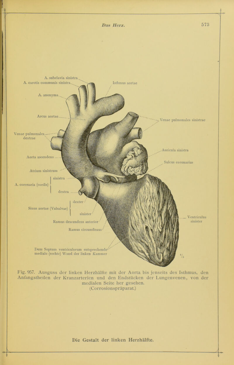 Isthmus aortae / / / Arcus aortae '-—A'enae pulmonales sinistrae Vcnae pulmonales — dextrae \ A. subclavia sinistra A. carotis communis sinistra^ A. anonyma.^ Atrium sinistrum •' sinistra - A. coronaria (cordis) dextra Sinus aortae (Valsalvae) dexter sinister' i t Ramus descendcns anterior Ramus circumflexus •' Dem Septum ventriculorum entsprechende'- mediale (rechte) Wand der linken Kammer _ Auricula sinistra Sulcus coronarius Ventriculus sinister Aorta ascendens Fig. 957. Ausguss der linken Herzhälfte mit der Aorta bis jenseits des Isthmus, den Anfangstheilen der Kranzarterien und den Endstücken der Lungenvenen, von der medialen Seite her gesehen. (Corrosionspräparat.)