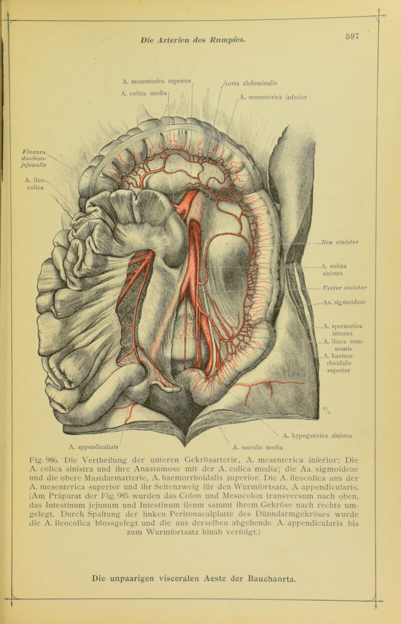 Flexuva __ claocleno- jejunalis A. ileo-^ colica \ .ßen sinister A. colica sinistra ■ Ureter sinister -Aa. sigmoideac -A. spermatica interna ..A. iliaca com- munis . A. liaemor- rhoidalis superior A. hypogastrica sinistra A. sacraüs media A. appendicularis Aorta abdominalis i i i ,A. mesenterica inferior / / 1 / A. mesenterica superior f A. colica media] I Fig. 986. Die Vertheilung der unteren Gekrösarterie, A. mesenterica inferior: Die A. colica sinistra und ihre Anastomose mit der A. colica media; die Aa. sigmoideae und die obere Mastdarmarterie, A. haemorrhoidalis superior. Die A. ileocolica aus der A. mesenterica superior und ihr Seitenzweig für den Wurmfortsatz, A. appendicularis. (Am Präparat der Fig. 985 wurden das Colon und Mesocolon transversum nach oben, das Intestinum jejunum und Intestinum ileum sammt ihrem Gekröse nach rechts um- gelegt. Durch Spaltung der linken Peritonaealplatte des Dünndarmgekröses wurde die A. ileocolica blossgelegt und die aus derselben abgehende A. appendicularis bis zum Wurmfortsatz hinab verfolgt.)