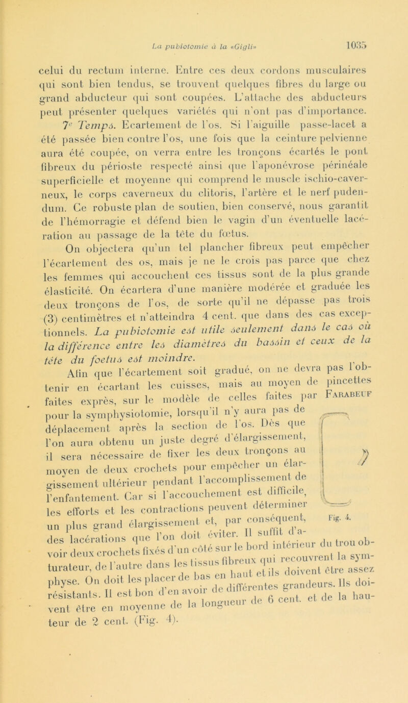 celui du redimi interne. Enlre ces deux cordons musculaires qui s.ont bien tendus, se trouvent quelques fibres du large 011 grand abducteur qui sont coupóes. L’attache des abducteurs peut présenter quelques variétés qui n oni pas d’importance. 7l' Tempà. Ecartement de l'os. Si Eaiguille passe-lacet a été passée bien contre l’os, ime fois que la ceinture pelvienne aura été coupée, on verrà entre les troncons écartés le pont fìbreux du périoste respecté ainsi que baponévrose périnéale superfìcielle et moyenne qui comprend le illusele ischio-caver- neux, le corps caverneux du clitoris, l’artère et le nerf puden- dum. Ce robuste pian de soutien, bien conservé, nous garantit de l’hémorragie et défend bien le vagin d’un éventuelle lacé- ration au passage de la tòte du feetus. On objectera qu’un tei plancher fìbreux peut empècher Eécarlement des os, mais je ne le crois pas parce que chez les femmes qui accouchent ces tissus soni de la plus glande élasticité. On écartera d’une manière modérée et graduée les deux tronQons de l'os, de sorte quii ne dépasse pas trois (3) centimètres et n’atteindra 4 cent, que dans des cas excep- tionnels. La pubiotomie eót utile óeulement danó le caó ou la différence entre leó diamètreó du baóàin et ceux de la tòte du foetuó eót. moindre. Atin que récartement soit gradué, on ne devra pas 1 ob- lenir en écartant les cuisses, mais au moyen de pincettes faites exprès, sur le modèle de celle* faites par Farabm r pour la symphysiotomie, lorsqu'il n’y aura pas de déplacement après la sedioli de 1 os. U< s que l’on aura obtenu un juste degré d’élargissement, il sera nécessaire de fixer les deux Irongons au moven de deux crochets pour empòri,er un elar- gissement ultérieur pendant laccomplissemenl de ì’enfantement. Car si laccouchement est difficile, Ics efforts et Ics contractions peuvenl determinei un plus grand élargissemenl et, pai ( onseqiien , des lacérations que fon du ,ouob. voir deux crochets fìxes d un co - ■ 1 svili- turateur, de l autre dans les tissus fibre» pbyse. On doit les piacer de hz* grandeurs. Ils doi- résistants. 11 est bon .1 c a ,le 6 cent, et de la bau- veni è ire en moyenne de la lonDi teur de 2 cent. (Fig. 4). Fig. 4.