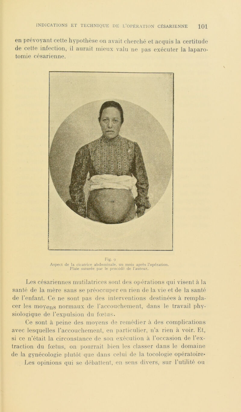 en prévoyant cette hypothèse on avait cherché et acquis la certitude de cette infection, il aurait mieux valu ne pas exécuter la laparo- tomie césarienne. Fig. 9 Aspect de la cicatrice abdominale, un mois après l’opération. Plaie suturée par le procédé de l’auteur. Les césariennes mutilatrices sont des opérations qui visent à. la santé de la mère sans se préoccuper en rien de la vie et de la santé de l’enfant. Ce ne sont pas des interventions destinées à rempla- cer les moyens normaux de l’accouchement, dans le travail phy- siologique de l’expulsion du fœtus. Ce sont à peine des moyens de remédier à des complications avec lesquelles l’accouchement, en particulier, n’a rien à voir. Et, si ce n’était la circonstance de son exécution à l’occasion de l’ex- traction du fœtus, on pourrait bien les classer dans le domaine de la gynécologie plutôt que dans celui de la tocologie opératoire* Les opinions qui se débattent, en sens divers, sur l’utilité ou