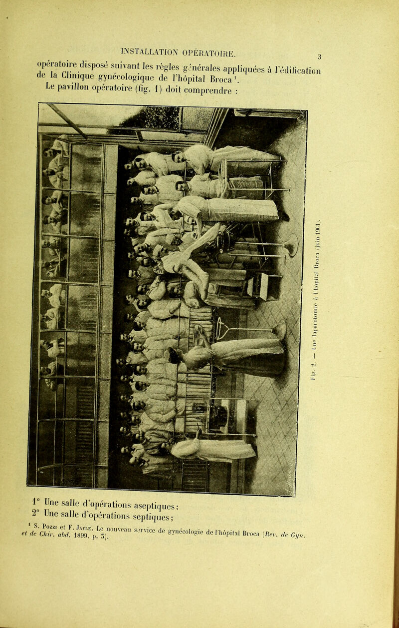 opératoire disp°sé suivant les règles générales appliquées à l'édification de la Clinique gynécologique de l’hôpital Broca1. Ce pavillon opératoire (fig. 1) doit comprendre : 1° Une salle d 2° Une salle d' opérations aseptiques opérations septiques ; et deChir!abd.\899K p}nouvea 11 S3rvice de gynécologie de l'hôpital Broca (Rev. de G, ^i tl [,|lp laparotomie à l liôpital Uroca (juin 1901).