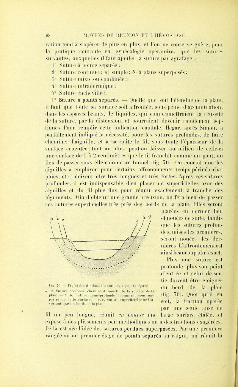 cation tend à s’opérer de plus en plus, el l’on ne conserve guère, pour la pratique courante en gynécologie opératoire, que les sutures suivantes, auxquelles il faut ajouter la suture par agrafage : J Suture à points séparés : *2’ Suture continue : a) simple; b) à plans superposés: :»u Suture mixte ou combinée; 4° Suture intradermique ; 5° Suture euchexillée. lü Suture à points séparés. — Ouelle que soit l'étendue de la plaie, il faut que toute sa surface soit affrontée, sous peine d’accumulation, dans les espaces béants, de liquides, qui compromettraient la réussite de la suture, par la distension, et pourraient devenir rapidement sep- tiques. Pour remplir cette indication capitale, Ilegar, après Simon, a parfaitement indiqué la nécessité, pour les sutures profondes, de faire cheminer l’aiguille, et à sa suite le fil, sous toute l’épaisseur de la surface eruentée; tout au plus, peut-on laisser au milieu de celle-ci une surface de I à 2 centimètres que le lil franchit comme un pont, au lieu de passer sous elle comme un tunnel (fig. 7(1). On conçoit que les aiguilles à employer pour certains affrontements (colpo-périnéorrha- phies, etc.) doivent être très longues et très fortes. Après ces sutures profondes, il est indispensable d'en placer de superficielles avec des aiguilles et du lil plus lins, pour réunir exactement la tranche des téguments. Afin d'obtenir une grande précision, on fera bien de passer ces sutures superficielles très près des bords de la plaie. Elles seront placées en dernier lieu et nouées de suite, tandis que les sutures profon- des, mises les premières, seront nouées les der- nières. L'aifrontement est ainsi beaucoup plusexaet. Plus une suture est profonde, plus son point d’entrée el celui de sor- tie doivent être éloignés du bord de la plaie (fig. 76). Quoi qu'il en soit, la traction opérée par une seule anse de lil un peu longue, réunit en bourse une large surface étalée, et expose à des plissements peu méthodiques ou à des tractions exagérées. Ite là est née l'idée des sutures perdues superposées. Par une première rangée ou un premier étage de points séparés au catgut, on réunit la l'ig. 7G. — Trajet des tils dans les sutures à points séparés. a. a. Suture profonde elieminant sous toute la surface de la plaie. — b. b. Suture demi-profonde cheminant sous une partie de cette surface. — c. c. Suture superficielle ne tra- versant que les bords do la plaie.