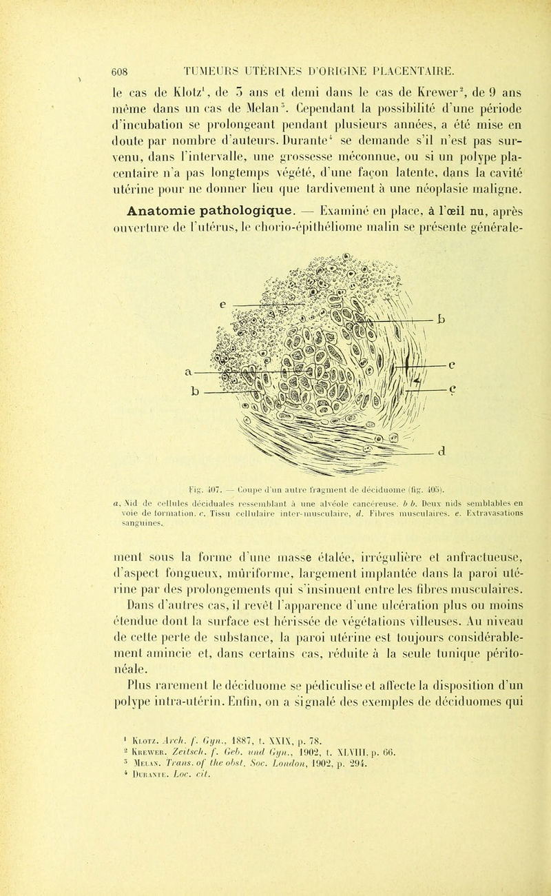 le cas de Klotz1, de 5 ans et demi dans le cas de Krewer2, de 9 ans même dans un cas de Melan3. Cependant la possibilité d’une période d’incubation se prolongeant pendant plusieurs années, a été mise en doute par nombre d’auteurs. Durante4 se demande s’il n’est pas sur- venu, dans l’intervalle, une grossesse méconnue, ou si un polype pla- centaire n’a pas longtemps végété, d’une façon latente, dans la cavité utérine pour ne donner lieu que tardivement à une néoplasie maligne. Anatomie pathologique. — Examiné en place, à l’œil nu, après ouverture de t utérus, le chorio-épithéliome malin se présente générale- fig. -107. — Coupe d'un autre fragment île déciduome (fig. -105). a. Nid de cellules déciduales ressemblant à une alvéole cancéreuse, b b. Deux nids semblables en voie de formation, c. Tissu cellulaire inter-musculaire, d. Fibres musculaires, e. Extravasations sanguines.. ment sous la forme d’une masse étalée, irrégulière et anfractueuse, d’aspect fongueux, mùriforme, largement implantée dans la paroi uté- rine par des prolongements qui s’insinuent entre les libres musculaires. Dans d’autres cas, il revêt l’apparence d’une ulcération plus ou moins étendue dont la surface est hérissée de végétations villeuses. Au niveau de cette perte de substance, la paroi utérine est toujours considérable- ment amincie et, dans certains cas, réduite à la seule tunique périto- néale. Plus rarement le déciduome se pédiculiseet affecte la disposition d’un polype intra-utérin. Enfin, on a signalé des exemples de déciduomes qui 1 Klotz. Arc h. f. Gyn., 1887, t. XXIX, p. 78. â Krewer. Zeitsch. f. Geb. uad Gyn., 1902, t. XLMII, p. 06. 5 Melan. Traits, of the obst. Soc. London, 1902, p. 291. 4 Durante. Loc. cit.