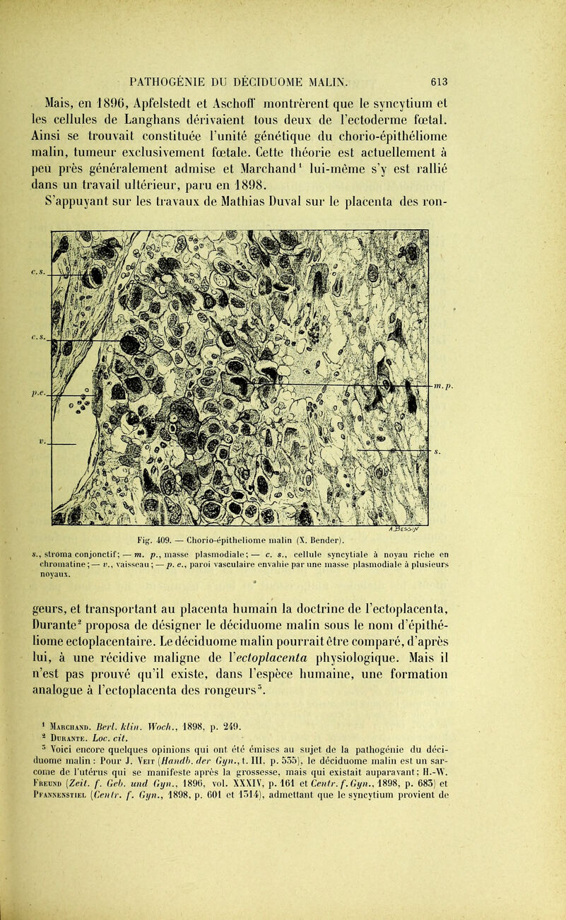 Mais, en 1896, Apfelstedt et Aschoff montrèrent que le syncytium et les cellules de Langhans dérivaient tous deux de l’ectoderme fœtal. Ainsi se trouvait constituée l’unité génétique du chorio-épithéliome malin, tumeur exclusivement fœtale. Cette théorie est actuellement à peu près généralement admise et Marchand1 lui-mème s’y est rallié dans un travail ultérieur, paru en 1898. S’appuyant sur les travaux de Mathias Duval sur le placenta des ron- Fig. 409. — Chorio-épitheliome malin (X. Bender). s., stroma conjonctif; — m. p., masse plasmodiale;— c. s., cellule syncytiale à noyau riche en chromatine;— v., vaisseau; — p. e., paroi vasculaire envahie par une masse plasmodiale à plusieurs noyaux. geurs, et transportant au placenta humain la doctrine de l’ectoplacenta. Durante2 proposa de désigner le déciduome malin sous le nom d’épithé- liome ectoplacentaire. Le déciduome malin pourrait être comparé, d’après lui, à une récidive maligne de Yectoplacenta physiologique. Mais il n’est pas prouvé qu’il existe, dans l’espèce humaine, une formation analogue à l’ectoplacenta des rongeurs3. 1 Marchand. Berl. klin. JVoclt., 1898, p. 249. 4 Durante. Loc. cit. 3 Voici encore quelques opinions qui ont élé émises au sujet de la palhogénie du déci- duome malin : Pour J. Yeit (Handb. lier Gyn., t. III. p. 535), le déciduome malin est un sar- come de l’utérus qui se manifeste après la grossesse, mais qui existait auparavant; H.-W. Kreund [Zeit. f. Geb. und Gyn., 1896, vol. XXXIV, p. 161 et Centr. f. Gyn., 1898, p. 683) et Pfannenstiel (Genlr. /'. Gyn., 1898, p. 601 et 1314), admettant que le syncytium provient de