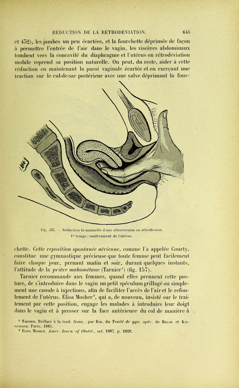 et 452), les jambes un peu écartées, et la fourchette déprimée de façon à permettre l’entrée de l’air dans le vagin, les viscères abdominaux tombent vers la concavité du diaphragme et l’utérus en rétrodéviation mobile reprend sa position naturelle. On peut, du reste, aider à cette réduction en maintenant la paroi vaginale écartée et en exerçant une traction sur le cul-de-sac postérieur avec une valve déprimant la four- Fig'. 453. — Réduction bi-manuelle d'une rétroversion ou rétroflexion. 1 temps : soulèvement de l’utérus. chette. Cette reposition spontanée aérienne, comme l’a appelée Courty, constitue une gymnastique précieuse que toute femme peut facilement faire chaque jour, prenant matin et soir, durant quelques instants, l’attitude de la prière mahomêtane (Tarnier1) (fig. 157). Tarnier recommande aux femmes, quand elles prennent cette pos- ture, de s’introduire dans le vagin un petit spéculum grillagé ou simple- ment une canule à injections, afin de faciliter l’accès de l’air et le refou- lement de l’utérus. Élisa Mosher2, qui a, de nouveau, insisté sur le trai- tement par cette position, engage les malades à introduire leur doigt dans le vagin et à presser sur la face antérieure du col de manière à 1 Ta h mk ii. Préface à la trad. franc., par Bar, du Traité de gyn. oj<ér. de Hegar et Kal- tf.ncacii. Paris, 1885. 2 Elisa Mosher. Amer. Jauni, of Obstet., oct. 1887, p. 10‘28.