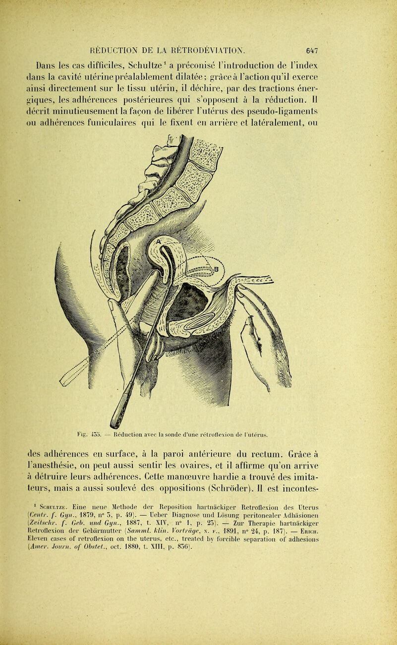 Dans les cas difficiles, Schultze1 a préconisé l’introduction de l'index dans la cavité utérine préalablement dilatée; grâce à l’action qu’il exerce ainsi directement sur le tissu utérin, il déchire, par des tractions éner- giques, les adhérences postérieures qui s’opposent à la réduction. Il décrit minutieusement la façon de libérer l’utérus des pseudo-ligaments ou adhérences funiculaires qui le fixent en arrière et latéralement, ou des adhérences en surface, à la paroi antérieure du rectum. Grâce à l'anesthésie, on peut aussi sentir les ovaires, et il affirme qu’on arrive à détruire leurs adhérences. Cette manœuvre hardie a trouvé des imita- teurs, mais a aussi soulevé des oppositions (Schrôder). 11 est incontes- 1 Schultze. Eine neuc Méthode der Reposition hartnâckiger Retroflexion des Utérus [Centr. f. Gyn., 1879, n° 5, p. 49). — Ucber Diagnose und Losung peritonealer Adhâsionen (Zeilschr. /'. Geb. und Gyn., 1887, t. XIV, n° 1, p. 25). — Zur Thérapie hartnâckiger Relroilexion der Gebârmutter [Samml. klin. Vortrâge, k. f., 1891, n 24, p. 187). — Erich. Eleven cases of retroflexion on the utérus, etc., treated hv foi-cible séparation ol' adhesions (Amer. Journ. of Obstet., oct. 1880, t. XIII, p. 856).