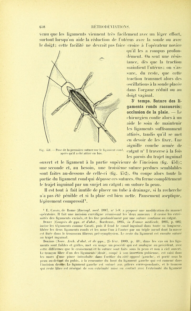 venu que les ligaments viemienl 1res facilement, avec un léger effort, surtout lorsqu'on aide la réduction de l'utérus avec la sonde ou avec le doigt; cette facilité ne devrait pas faire croire à l'opérateur novice qu’il les a rompus profon- dément. On seul une résis- tance, dès que la traction maintient l'utérus; on s’as- sure, du reste, que cetle traction transmet alors des oscillations à la sonde placée dans l'organe réduit ou au doigt vaginal. 3 temps. Suture des li- gaments ronds raccourcis; occlusion de la plaie. — Le chirurgien confie alors à un aide le soin de maintenir les ligaments suffisamment attirés, tandis qu’il se met en devoir de les fixer. Une aiguille courbe armée de t’ig. -151. — Pose de la première suture sur le ligament rond, cjpnqif } traverse à la fois après qu’il a été attiré en bas. ^ 1 ’ 1 les parois du trajet inguinal ouvert et le ligament à la partie supérieure de l'incision (lig. 451); une seconde et, au besoin, une troisième suture perdues semblables sont faites au-dessous de celle-ci (lig. 452). On coupe alors toute la partie du ligament rond qui dépasse ces sutures. On ferme complètement le trajet inguinal par un surjet au catgut: on suture la peau. Il est tout à fait inutile de placer un tube à drainage, si la recherche n'a pas été pénible et si la plaie est bien nette. Pansement aseptique, légèrement compressif1. 1 E. Casati, de Rome (Raccogl. med. 1887. n” 5-8) a proposé une modification du manuel opératoire. Il fait line incision curviligne réunissant les'deux anneaux : il croise les extré- mités des ligaments excisés, et les fixe profondément par une suture continue au catgut. Duret (Congrès de gyn. et d'obsl., Bordeaux, 1895, in France médicale, 1895, p. 604, incise les téguments comme Casati, puis il fend le canal inguinal dans toute sa longueur, libère les deux ligaments ronds et les noue l'un à l'autre par un triple nœud dont la masse est fixée dans le trousseau fibreux pré-sympliysien. Le reste du ligament est ensuite suturé au trajet inguinal. Doléris (Nouv. Arch. d'obsl. et de gyn.. 25 févr. 1889. p. 49), dans les cas où les liga- ments sont faibles et grêles, met en usage un procédé qui est analogue au précédent, avec cette différence que le croisement et la suture sont faits sous la peau et non à ciel ouvert. Le tronçon libre d’un des ligaments (droit), coupé a son insertion pubienne, est saisi dans les mors d’une pince introduite dans l'orifice du .côté opposé (gauche), et porté sous la peau au-devant du pubis, à la rencontre du bout du ligament gauche qui est ramené dans I incision drente. I.c ligament'gauche est suturé aux piliers correspondants, et. le tronçon qui reste libre est réséqué de son extrémité mise mi contact avec l’extrémité du ligament