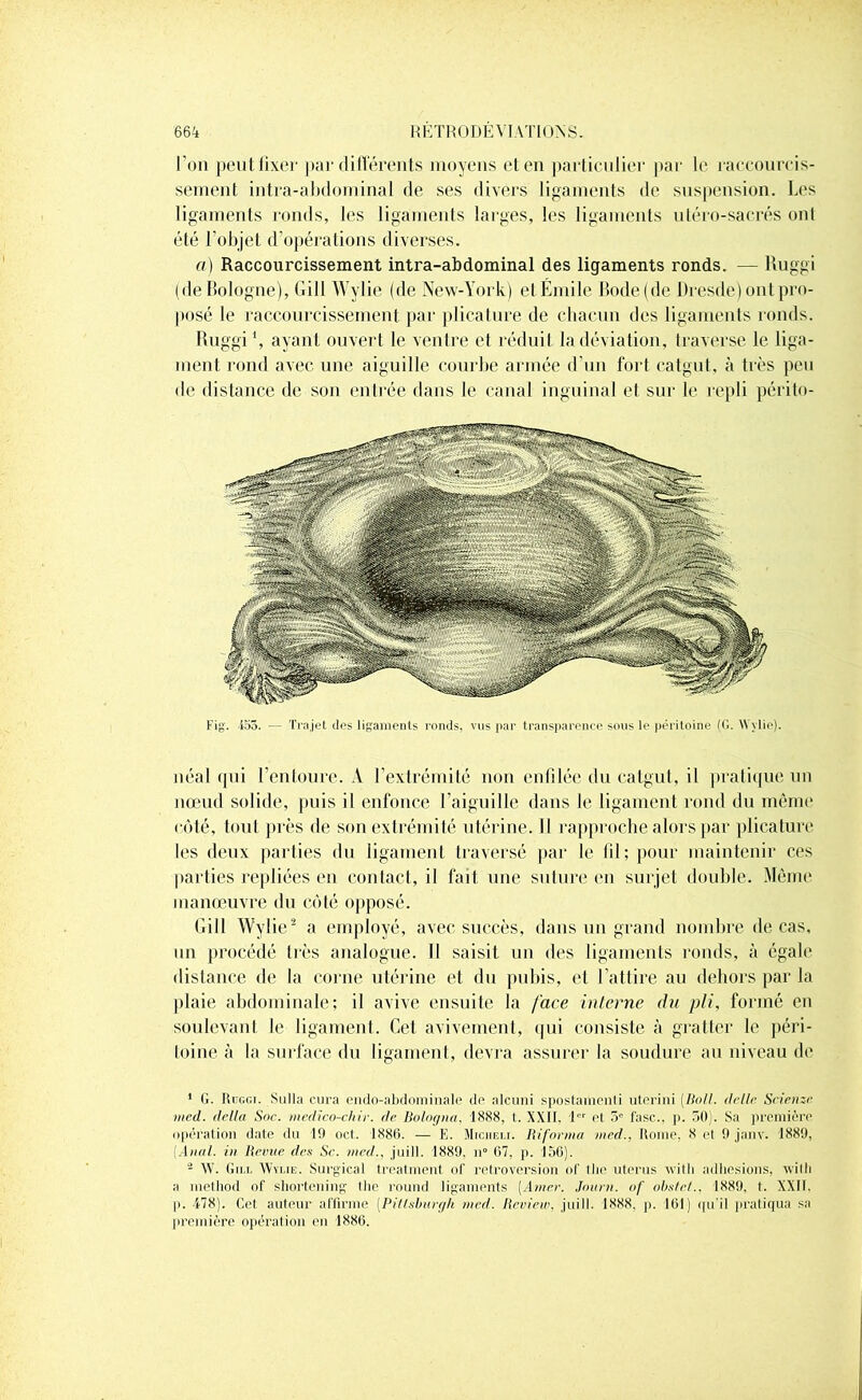l’on peut fixer par différents moyens et en particulier par le raccourcis- sement intra-abdominal de ses divers ligaments de suspension. Les ligaments ronds, les ligaments larges, les ligaments utéro-sacrés ont été l’objet d’opérations diverses. a) Raccourcissement intra-abdominal des ligaments ronds. — Ruggi (de Bologne), Gi 11 Wylie (de New-York) et Émile Bode(de Dresde) ont pro- posé le raccourcissement par plicature de chacun des ligaments ronds. Ruggi1, ayant ouvert le ventre et réduit la déviation, traverse le liga- ment rond avec une aiguille courbe armée d’un fort catgut, à très peu de distance de son entrée dans le canal inguinal et sur le repli périto- néal qui l’entoure. A l’extrémité non enfilée du catgut, il pratique un nœud solide, puis il enfonce l’aiguille dans le ligament rond du même côté, tout près de son extrémité utérine. Il rapproche alors par plicature les deux parties du ligament traversé par le fil; pour maintenir ces parties repliées en contact, il fait une suture en surjet double. Même manœuvre du côté opposé. Gill Wylie2 a employé, avec succès, dans un grand nombre de cas, un procédé très analogue. Il saisit un des ligaments ronds, à égale distance de la corne utérine et du pubis, et l’attire au dehors par la plaie abdominale; il avive ensuite la face interne du pli, formé en soulevant le ligament. Cet avivement, qui consiste à gratter le péri- toine à la surface du ligament, devra assurer la soudure au niveau de ’ G. Ritggi. Sulla cura endo-abdominale do alcuni spostamenti utcrini [Boit. <telle Seienzc mcd. delta Soc. medïco-chir. de Bologna, 1888, t. XXII. ! et 5° fasc., p. 50). Sa première opération date du 19 oct. 1886. — E. Micheli. Riforma mcd., Rome, 8 et 9 janv. 1889, [Anal, in Revue des Sc. mcd., juill. 1889. n° 67, p. 156). â W. Gill Wylie. Surgical treatment of rétroversion of tlie utérus witli adhesions, willi a inethod of sliortening t lie round ligaments [Amer. Journ. of obstet., 1889, t. XXII. p. 178). Cet auteur affirme [Pittsburgh mcd. Review, juill. 1888. p. 161) qu'il pratiqua sa première opération en 1886.