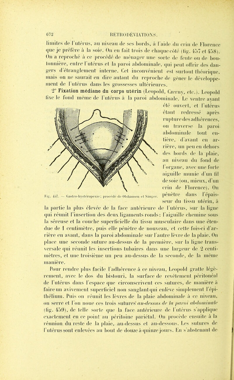 limites de l’utérus, au niveau de ses bords, à l'aide du crin de Florence que je préfère à la soie. On en fait trois de chaque coté (fig. 107 et 458). On a reproché à ce procédé de ménager une sorte de fente ou de bou- tonnière, entre l utérus et la paroi abdominale, qui peut offrir des dan- gers d’étranglement interne. Cet inconvénient est surtout théorique, mais on ne saurait en dire autant du reproche de gêner le développe- ment de l’utérus dans les grossesses ultérieures. 2° Fixation médiane du corps utérin (Léopold, Czerny, etc.). Léopold fixe le fond même de l’utérus à la paroi abdominale. Le ventre avant été ouvert, et l'utérus étant redressé après rupt lire des adhérences, on traverse la paroi abdominale tout en- tière, d’avant en ar- rière, un peu en dehors des bords de la plaie, au niveau du fond de l'organe, avec une forte aiguille munie d'un fil desoie (ou, mieux, d'un crin de Florence). Ou Fig. 437. — Gastro-hystéropexie ; M’océdé de Olshausen et Sânger. I1* 0* dans I tpais- seur du tissu utérin, à la partie la plus élevée de la face antérieure de l'utérus, sur la ligne qui réunit l’insertion des deux ligaments ronds; l'aiguille chemine sous ht séreuse et la couche superficielle du tissu musculaire dans une éten- due de 1 centimètre, puis elle pénètre de nouveau, et cette fois-ci d'ar- rière en avant, dans la paroi abdominale sur l'autre lèvre de la plaie. On place une seconde suture au-dessus de la première, sur la ligne trans- versale qui réunit les insertions tubaires dans une largeur de 2 centi- mètres, et une troisième un peu au-dessus de la seconde, de la même manière. Pour rendre plus facile l’adhérence à ce niveau, Léopold gratte légè- rement, avec le dos du bistouri, la surface de revêtement péritonéal de l’utérus dans l’espace que circonscrivent ces sutures, de manière à faire un avivement superficiel non sanglant qui enlève simplement l’épi- thélium. Puis on réunit les lèvres de la plaie abdominale à ce niveau, on serre et l’on noue ces trois sutures'au^dfàsits de la paroi abdominale (tig. 459), de telle sorte que la face antérieure de l'utérus s’applique exactement en ce point au péritoine pariétal. On procède ensuite à la réunion du reste de la plaie, au-dessus et au-dessous. Les sutures de l’utérus sont enlevées au bout de douze à quinze jours. En s'abstenant de
