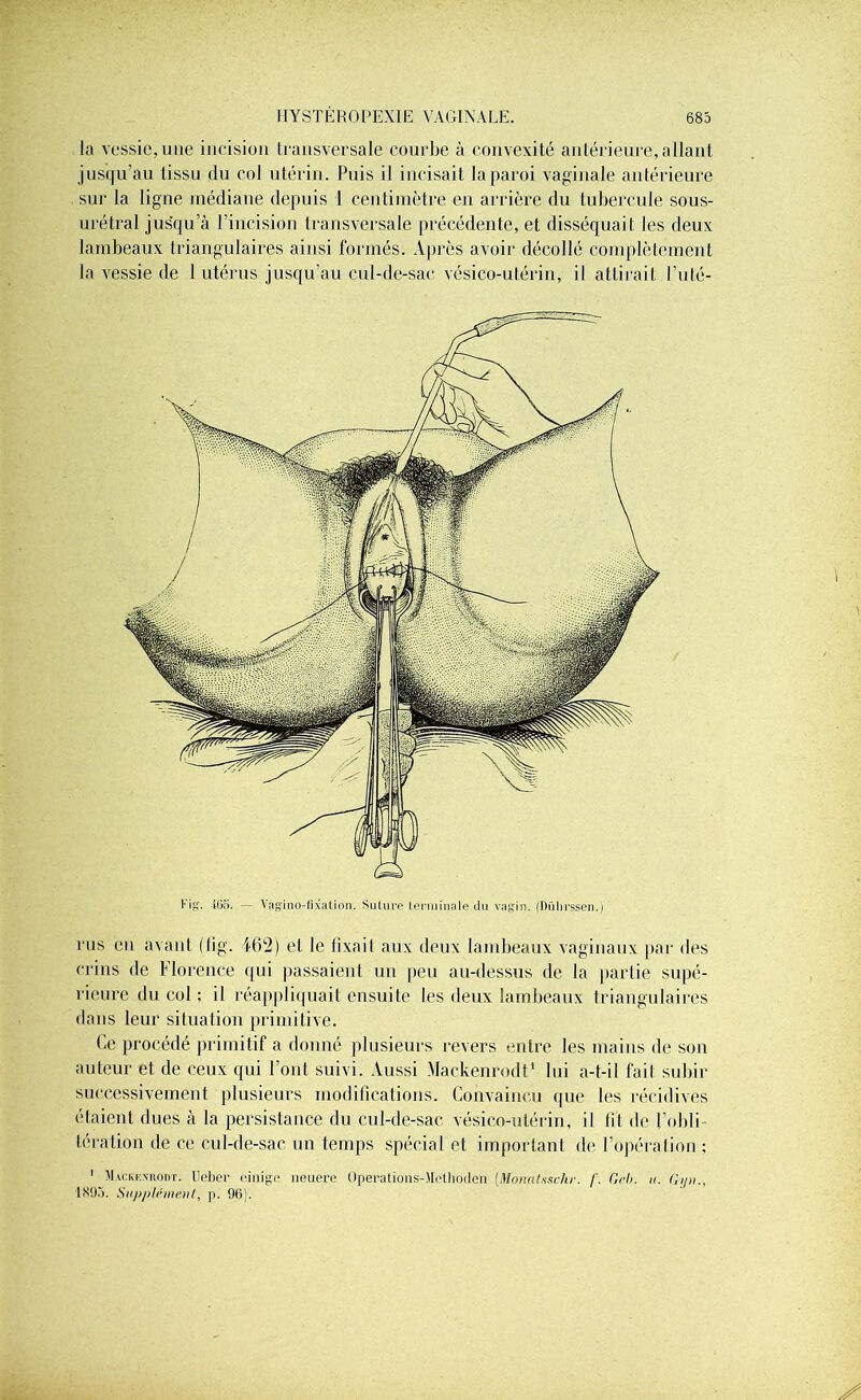 la vessie, une incision transversale courbe à convexité antérieure, allant jusqu’au tissu du col utérin. Puis il incisait la paroi vaginale antérieure sur la ligne médiane depuis 1 centimètre en arrière du tubercule sous- urétral jusqu’à l’incision transversale précédente, et disséquait les deux lambeaux triangulaires ainsi formés. Après avoir décollé complètement la vessie de 1 utérus jusqu’au cul-de-sac vésico-utérin, il attirait Futé- l'in- 465. — Vagino-lixation. Suture terminale du vagin. (Dülirssen.) rus en avant (fig. 462) et le fixait aux deux lambeaux vaginaux par des crins de Florence qui passaient un peu au-dessus de la partie supé- rieure du col ; il réappliquait ensuite les deux lambeaux triangulaires dans leur situation primitive. Ce procédé primitif a donné plusieurs revers entre les mains de son auteur et de ceux qui l’ont suivi. Aussi Mackenrodt4 lui a-t-il fait subir successivement plusieurs modifications. Convaincu que les récidives étaient dues à la persistance du cul-de-sac vésico-utérin, il fit de l’obli- tération de ce cul-de-sac un temps spécial et important de l’opération : 1 Mackenrodt. Ueber einige neuere Operations-Mellioden [Monatssckr. /'. Geb. u. Gyn., 1895. Supplément, p. 96).