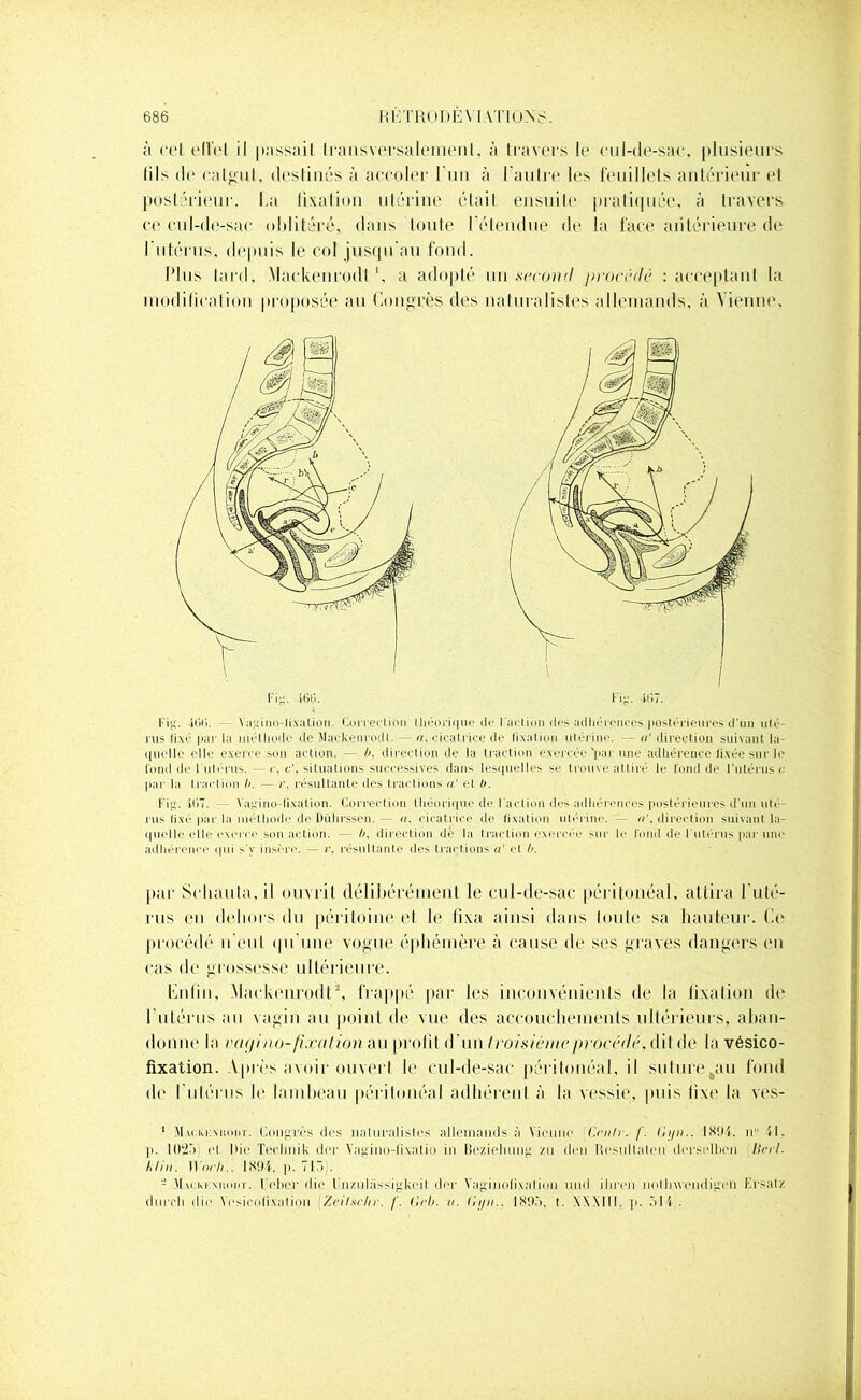 à cet effet il passait transversalement, à travers le cul-de-sac, plusieurs (ils de calcul, destinés à accoler l'un à l'autre les feuillets antérieur et postérieur. La fixation utérine était ensuite pratiquée, à travers ce cul-de-sac oblitéré, dans toute l'étendue de la face antérieure de I utérus, depuis le col jusqu'au fond. Plus tard, Mackenrodl ', a adopté un second procédé : acceptant la modification proposée an Congrès des naturalistes allemands, à Vienne, Fig. 4Gi». Y.igino-lixation. Correction théorique de l'action (les adhérences postérieures'd’un u(é- rus fixé par la inétliodo de Mackenrodl. «. cicatrice de fixation utérine. — «'direction suivant la- quelle elle exerce son action. — b, direction de la traction exercée 'par une adhérence fixée sur le fond de l'utérus. — c. csituations successives dans lesquelles se trouve attiré le fond de Futérus r par la traction b. — r, résultante des tractions «' et b. Fig. t(>7. Vagino-lixation. Correction théorique de Factioil des adhérences postérieures d’un uté- rus fixé par la méthode de Diilirssen.— «. cicatrice de fixation utérine. — «'.direction suivant la- quelle elle exerce son action. — b, direction de la traction exercée sur le fond de l utérus par une adhérence qui s’y insère. — r. résultante des tractions «' et b. par Scliaula, il ouvrit délibérément le cul-de-sac péritonéal, attira l'uté- rus en dehors du péritoine et le fixa ainsi dans toute sa hauteur. Ce procédé n'eut qu'une vogue éphémère à cause de ses graves dangers en cas de grossesse ultérieure. Lutin, Mackenrodl1 2, frappé par les inconvénients de la fixation de l'utérus au vagin au point de vue des accouchements ultérieurs, aban- donne la vapino-fixation au profil d'un troisième procédé,t\ il de la vésico- fixation. Après avoir ouvert le cul-de-sac péritonéal, il sulure.au fond de l'utérus le lambeau péritonéal adhérent à la vessie, puis fixe la ves- 1 Congrès des naturalistes allemands à Vienne Crntr. /'. Gyn.. 1894. n“ il. |i. 1025 el Oie Technik der Yagino-fixatio in Beziehung zu tien Ilesullalen derselbcn Uni. 1,1 in. Woch.. 1894. p. 713). - VIai:ki:mioht. UeBer die Unznlassigkeil der Vaginofixation uud iliren nollnvendigen Ersatz dnrcli die Yesicotixation [Zeilschr. /'. ('•(•!>. it. Gyn.. 189.3, t. XXXIII. p. 514 .