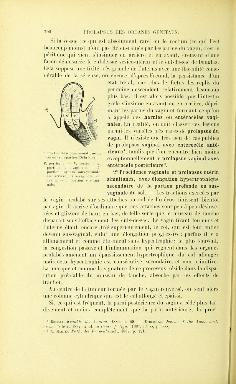 Si la vessie (ce qui est absolument rare) ou le rectum (ce qui l'est beaucoup moins) n’ont pas été en-raînés par les parois du vagin, c'est le péritoine qui vient s’insinuer en arrière et en avant, creusant d’une façon démesurée le cul-de-sac vésico-utérin et le cul-de-sac de Douglas. Cela suppose une fixité très grande de l'utérus avec une flaccidité consi- dérable de la séreuse, ou encore, d’après Freund, la persistance d'un état fœtal, car chez le fœtus les replis du péritoine descendent relativement beaucoup [dus bas. Il est alors possible que l’intestin grêle s’insinue en avant ou en arrière, dépri- mant les parois du vagin et formant ce qu’on a appelé des hernies ou entérocèles vagi- nales. En réalité, on doit classer ces lésions parmi les variétés très rares de prolapsus du vagin. Il n’existe que très peu de cas publiés de prolapsus vaginal avec entérocèle anté- rieure1, tandis que l’on rencontre bien moins exceptionnellement le prolapsus vaginal avec entérocèle postérieure2. 2° Procidence vaginale et prolapsus utérin simultanés, avec élongation hypertrophique secondaire de la portion profonde ou sus- vaginale du col. — Les tractions exercées par le vagin prolabé sur ses attaches au col de F utérus finissent bientôt par agir. Il arrive d’ordinaire que ces attaches sont peu à peu désinsé- rées et glissent de haut en bas, de telle sorte que le museau dé tanche disparaît sous Felfacemenl des culs-de-sac. Le vagin tirant toujours et l’utérus étant encore fixé supérieurement, le col, qui est tout entier devenu sus-vaginal, subit une élongation progressive; parfois il y a allongement et comme étirement sans hypertrophie; le plus souvent, la congestion passive et l’inflammation qui régnent dans les organes prolabés amènent un épaississement hypertrophique du col allongé; mais celte hypertrophie est consécutive, secondaire, et non primitive. La marque et comme la signature de ce processus réside dans la dispa- rition préalable du museau de tanche, absorbé par les efforts de traction. Au centre de la tumeur formée par le vagin renversé, on sent alors une colonne cylindrique qui est le col allongé et épaissi. Si, ce qui est fréquent, la paroi postérieure du vagin a cédé plus tar- divement et moins complètement que la paroi antérieure, la proci- 1 Bheisky. Kranlih. der Yagimt, 1886. p. 69. — Iyijieiudge. Jauni, of /lie Amer. med. Assoc., 5 févr. 1887 (Anal, in Cenlr. /'. Gyn., ISS7. n° 55, ]>. 555). 2 A. Mahtin. Palh. (1er Frauenlirnnli., 1887. p. 121. Fig. 171. Pi vision schéma tique du col en trois parties (Sclirôder). P, péritoine. — V, vessie. — a, portion sous-vaginale. — b, portion moyenne (sous-vaginale en arrière, sus-vaginale en avant). — c, portion sus-vagi- nale.