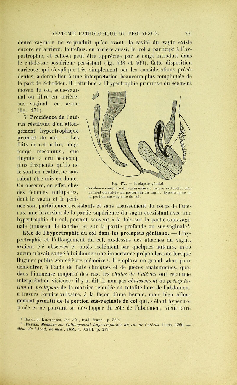 dence vaginale ne se produit qu’en avant; la cavité du vagin existe encore en arrière; toutefois, en arrière aussi, le col a participé à l’hy- pertrophie, et celle-ci peut être appréciée par le doigt introduit dans le cul-de-sac postérieur persistant (fig. 408 et 469). Cette disposition curieuse, qui s’explique très simplement par les considérations précé- dentes, a donné lieu à une interprétation beaucoup plus compliquée de la part de Schrôder. Il l’attribue à l’hypertrophie primitive du segment moyen du col, sous-vagi- nal ou libre en arrière, sus - vaginal en avant (fig. 471). 5° Procidence de l’uté- rus résultant d’un allon- gement hypertrophique primitif du col. — Les faits de cet ordre, long- temps méconnus, que llu guier a cru beaucoup plus fréquents qu’ils ne le sont en réalité, ne sau- raient être mis en doute. On observe, en effet, chez des femmes nullipares, dont le vagin et le péri- née sont parfaitement résistants et sans abaissement du corps de l’uté- rus, une inversion de la partie supérieure du vagin coexistant avec une hypertrophie du col, portant souvent à la fois sur la partie sous-vagi- nale (museau de tanche) et sur la partie profonde ou sus-vaginale h Rôle de l’hypertrophie du col dans les prolapsus génitaux. — L’hy- pertrophie et l’allongement du col, au-dessus des attaches du vagin, avaient été observés et notés isolément par quelques auteurs, mais aucun n’avait songé à lui donner une importance prépondérante lorsque Huguier publia son célèbre mémoire 1 2. Il employa un grand talent pour démontrer, à l’aide de faits cliniques et de pièces anatomiques, que, dans l'immense majorité des cas, les chutes de l'utérus ont reçu une interprétation vicieuse ; il y a, dit-il, non pas abaissement ou précipita- tion ou prolapsus de la matrice refoulée en totalité hors de l’abdomen, à travers l’orifice vulvaire, à la façon d’une hernie, mais bien allon- gement primitif de la portion sus-vaginale du col qui, s’étant hypertro- phiée et ne pouvant se développer du côté de l’abdomen, vient faire 1 Hegak el Kaltenbach, loc. cil., trad. franc., p. 559. - Huguier. Mémoire sur l'allongement hypertrophique du col de l'utérus. Paris, 1860. — Mém. de l'Acad. de méd., 1859, t. XXIII. p. 279. Fig. 472. — Prolapsus génital. Procidence complète du vagin épaissi; légère cystocèle; effa- cement du cul-de-sac postérieur du vagin: hypertrophie de la portion sus-vaginale du col.