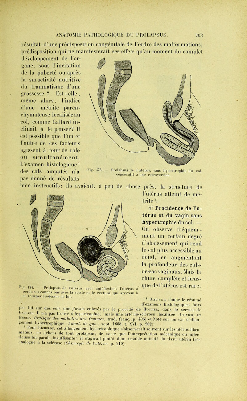 résultat d’une prédisposition congénitale de l’ordre des malformations, prédisposition qui ne manifesterait ses effets au’au moment du eomnlet développement de l’or- gane, sous l’incitation de la puberté ou après la suractivité nutritive du traumatisme d’une 9 Est - elle , l’indice grossesse même alors, d’une métrite paren- chymateuse localisée an col, comme Gallard in- clinait à le penser? Il est possible que l’un et l'autre de ces facteurs agissent à tour de rôle ou simultanément. L’examen histologique 1 des cols amputés n’a fis pas donné de résultats bien instructifs; ils avaient ‘475. — Prolapsus de l’utérus, sans hypertrophie du col, consécutif à une rétroversion. peu de chose près, la structure de l’utérus atteint de mé- trite2. 4° Procidence de l’u- térus et du vagin sans hypertrophie du col. — On observe fréquem - ment un certain degré d’abaissement qui rend le col plus accessible au doigt, en augmentant la profondeur des culs- de-sac vaginaux. Mais la chute complète et brus- F*. m. - Prolapsus de l'utérus avec antéflexion: l'utérus a (lue ,lc futéms est rare. peidu ses connexions avec la vessie et le rectum, qui arrivent ■ se toucher au-dessus de lui. Olivier a donné le résumé d’examens histologiques faits par lui sur des cols que j’avais enlevés par le procédé de Hiiguieu, dans le service de O Allard. Il n’a pas trouvé d’hypertrophie, mais une artério-sclérose localisée (Olivier, in bjniKT. Pratique des maladies des femmes, trad. franc., p. 490) et Vote sur un cas d'allon- gement hypertrophique [Annal, de gyn., sept. 1888, t.'XVI, p. 202). Pour Riciielot, cet allongement hypertrophique s’observerait souvent sur les utérus fibro- mateux. en dehors de tout prolapsus, de sorte que l’interprétation mécanique ou infec oeuse lui paraît insuffisante; il s’agirait plutôt d’un trolible nutritif du tissu utérin très analogue à la sclérose (Chirurgie de l'ulérus, p. 219).