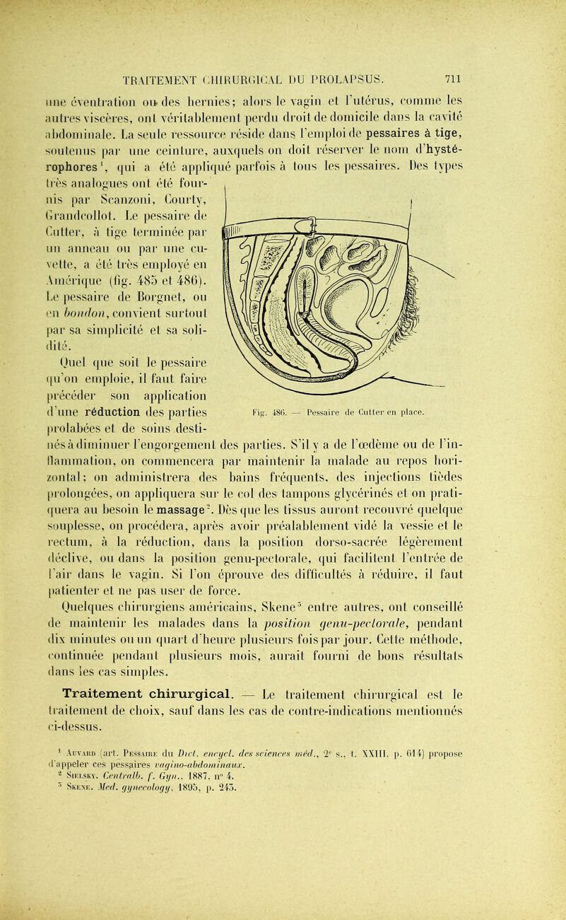 une éventration ou des hernies; alors le vagin et l’utérus, comme les autres viscères, ont véritablement perdu droit de domicile dans la cavité abdominale. La seule ressource réside dans l’emploi de pessaires à tige, soutenus par une ceinture, auxquels on doit réserver le nom d’hysté- rophores', qui a été appliqué parfois à tous les pessaires. Des types très analogues ont été four- nis par Scanzoni, Courty, Grandcollot. Le pessaire de Cutter, à tige terminée par un anneau ou par une cu- vette, a été très employé en Amérique (fig. 485 et 486). Le pessaire de Borgnet, ou en bondon, convient surtout par sa simplicité et sa soli- dité. Quel que soit le pessaire qu’on emploie, il faut famé précéder son application d’une réduction des parties prolabées et de soins desti- nés à diminuer l’engorgement des parties. S’il y a de l’œdème ou de Cin- llammation, on commencera par maintenir la malade au repos hori- zontal; on administrera des bains fréquents, des injections tièdes prolongées, on appliquera sur le col des tampons glycérinés et on prati- quera au besoin le massage1 2. Dès que les tissus auront recouvré quelque souplesse, on procédera, après avoir préalablement vidé la vessie et le rectum, à la réduction, dans la position dorso-sacrée légèrement déclive, ou dans la position genu-pectorale, qui facilitent Centrée de l’air dans le vagin. Si l’on éprouve des difficultés à réduire, il faut patienter et ne pas user de force. Quelques chirurgiens américains, Skene3 entre autres, ont conseillé de maintenir les malades dans la position genu-peclorale, pendant dix minutes ou un quart d’heure plusieurs fois par jour. Cette méthode, continuée pendant plusieurs mois, aurait fourni de bons résultats dans les cas simples. Traitement chirurgical. — Le traitement chirurgical est le traitement de choix, sauf dans les cas de contre-indications mentionnés ci-dessus. 1 Auvard (art. Pessaire du Dict. encycl. des sciences wéd., 2e s., (. XXIII. p. 614) propose d'appeler ces pessaires vagmo-abdominaux. 2 SiELSKv. Centralb. f. Gyn.. 1887. ir 4. ° Skene. Med. gynecology, 1895, p. 245.