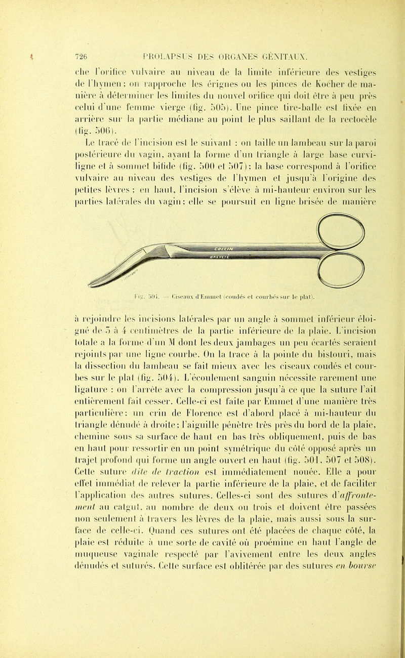 che l’orifice vulvaire au niveau de la limite inférieure des vestiges de 1 hymen: on rapproche les érignes ou les pinces de hocher de ma- nière à déterminer les limites du nouvel orifice qui doit être à peu près celui d’une femme vierge (fig. 505). Une pince tire-balle esl lixée en arrière sur la partie médiane au point le plus saillant de la rectocèle (lig. 500). Le tracé de l'incision esl le suivant : on taille un lambeau sur la paroi postérieure du vagin, ayanl la forme d’un triangle à large hase curvi- ligne et à sommet bifide (fig. 500 et 507): la hase correspond à l'orifice vulvaire au niveau des vestiges de I hymen el jusqu’à l'origine des pcliles lèvres; en haut, l’incision s’élève à mi-hauteur environ sur les parties latérales du vagin; elle se poursuit en ligne brisée de manière à rejoindre les incisions latérales par un angle à sommet inférieur éloi- gné de 5 à 4 centimètres de la partie inférieure de la plaie. L’incision totale a la forme d un M dont les deux jambages un peu écartés seraient rejoints par une ligne courbe. On la trace à la pointe du bistouri, mais la dissection du lambeau se fait mieux avec les ciseaux coudés et cour- bes sur le plat (fig. 504). L’écoulement sanguin nécessite rarement une ligature : on l'arrête avec la compression jusqu’à ce que la suture l'ait entièrement fait cesser. Celle-ci est faite par Emmet d'une manière très particulière: un crin de Florence est d’abord placé à mi-hauteur du triangle dénudé à droite; l’aiguille pénètre très près du bord de la plaie, chemine sous sa surface de haut en bas très obliquement, puis de bas en haut pour ressortir en un point symétrique du côté opposé après un trajet profond qui forme un angle ouvert en haut (fig. 501, 507 et 508). Cette suture dite de traction esl immédiatement nouée. Elle a pour effet immédiat de relever la partie inférieure de la plaie, et de faciliter I application des autres sutures. Celles-ci sont des sutures A affronte- ment au catgut, au nombre de deux ou trois et doivent être passées non seulement à travers les lèvres de la plaie, mais aussi sous la sur- face de celle-ci. Quand ces sutures ont été placées de chaque côté, la plaie esl réduite à une sorte de cavité où proémine en haut l'angle de muqueuse vaginale respecté par l’avivement entre les deux angles dénudés et suturés. Celte surface est oblitérée par des sutures en bourse