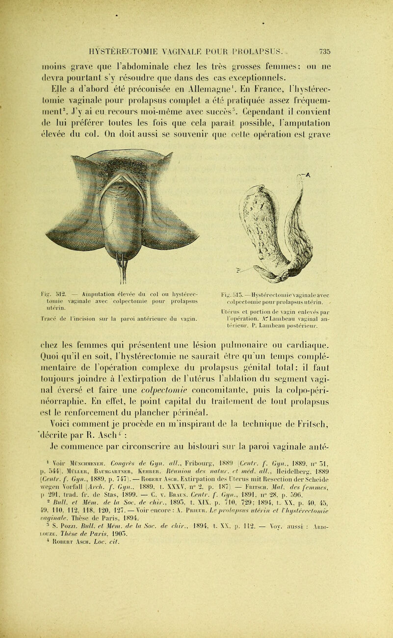 moins grave que l’abdominale chez les très grosses femmes; on ne devra pourtant s’y résoudre que dans des cas exceptionnels. Elle a d’abord été préconisée en Allemagne1. En France, ('hystérec- tomie vaginale pour prolapsus complet a été pratiquée assez fréquem- ment2. J’y ai eu recours moi-même avec succès3. Cependant il convient de lui préférer toutes les fois que cela parait possible, l’amputation élevée du col. On doit aussi se souvenir que cette opération est grave chez les femmes qui présentent une lésion pulmonaire ou cardiaque. Quoi qu’il en soit, F hystérectomie ne saurait être qu’un temps complé- mentaire de l’opération complexe du prolapsus génital total; il faut toujours joindre à l’extirpation de l’utérus l’ablation du segment vagi- nal éversé et faire une colpectomie concomitante, puis la colpo-péri- néorraphie. En effet, le point capital du traitement de tout prolapsus est le renforcement du plancher périnéal. Voici comment je procède en m’inspirant de la technique de Frifsch, décrite par R. Ascii4 : Je commence par circonscrire au bistouri sur la paroi vaginale anté- 1 Voir Mëxchmkyer. Congrès de Gyn. ail., Fribourg', 1889 [Centr. /'. Gyn., 1889. n° 51, p. 544). Muller, Baumgartxer, Keiirer. Réunion des nalur. cl méd. ail., Heidelberg', 1889 [Centr. f. Gyn., 1889. p. 747). — Robert Ascii. Extirpation dos l'Ierus mit Résection derScheide wegen Yorfall (.4r<7t. f. Gyn.. 1889, I. XXXV. n° 2, p. 187) — Fritscii. Mal. des femmes, p 291, trad. fr. de Stas. 1899. — C. v. Brait*. Centr. f. Gyn., 1891. n° 28. p. 596. 2 Hall, et Ment, de la Soc. de chir., 1893. t. XIX. p. 710, 729; 1894, t. XX. p. 40. 45, 49, 110, 112. 118. 120, 127. — Voir encore : A. Prieur. Le prolapsus utérin el l'hystérectomie caginalc. Thèse de Paris, 1894. 5 S. Pozzi. Rail, et Mém. de la Soc. de chir., 1894, t. NX. p. 112. — Yov. aussi : Ardi- i.ouze. Thèse de Paris, 1903. 4 Robert Ascii. Loc. cit. Fig. 512. — Amputation élevée du col ou hystérec- tomie vaginale avec colpectomie pour prolapsus utérin. Fig. 515. — Hystérectomie vaginale avec colpectomie pour prolapsus utérin. Utérus et portion de vagin enlevés par l'opération. ATLambeau vaginal an- térieur. P. Lambeau postérieur. Tracé de l'incision sur la paroi antérieure du vagin.