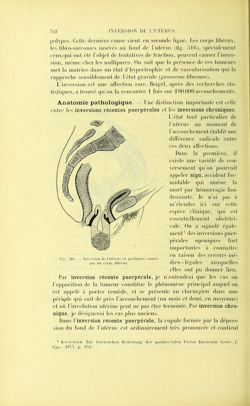 polypes. Celle dernière cause vient en seconde ligne. Les corps fibreux, les libro-sarcomes insérés au fond de l'utérus (fig. 51 b), spécialement ceux qui ont été l’objet de tentatives de traction, peuvent causer l'inver- sion, même chez les nullipares. On sait que la présence de ces tumeurs met la matrice dans un état d'hypertrophie et de vascularisation qui la rapproche sensiblement de l’état gravide (grossesse fibreuse). L’inversion esl une affection rare. Beigel, après des recherches sta- tistiques, a trouvé qu’on la rencontre I fois sur 190000 accouchements. Anatomie pathologique. Une distinction importante esl celle outre les inversions récentes puerpérales et les inversions chroniques. Par inversion récente puerpérale, je n’entendrai que les cas où l’apparition de la tumeur constitue le phénomène principal auquel on est appelé à porter remède, et se présente au chirurgien dans une période qui suit de près l'accouchement (un mois et demi, en moyenne) et où l'involution utérine peut ne pas être terminée. Par inversion chro- nique, je désignerai les cas plus anciens. Dans l'inversion récente puerpérale, la cupule formée par la dépres- sion du fond de l'utérus esl ordinairement très prononcée et contient 1 Kai.tkm'ac.ii. Ziir forensiclipn LMpiiliing. dor postmorlnlon Htprns Invorsion C.rn/r. /'. Gi/n.. IN7”>. p. 0541. L’état tout particulier de l'utérus au moment de 1 accouchement établit une différence radicale entre ces deux affections. Dans la première, il existe une variété de ren- versement qu’on pourrait appeler aigu, accident for- Fig. 511). Invorsion do Fiilérus cl prolapsus oansds par un corps fibreux. midable qui amène la mort par hémorragie fou- droyante. Je n’ai pas à m’étendre ici sur cette espèce 'clinique, qui est essentiellement obstétri- cale. On a signalé égale- ment1 des inversions puer- pérales agonique* fort importantes à connaître (ni raison des erreurs mé- dico - légales auxquelles elles ont pu donner lieu.