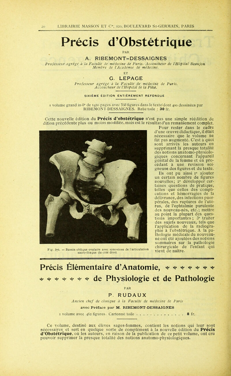 Précis d’Obstétrique PAR A. RIBEMONT-DESSAIGNES Professeur agrégé à la Faculté de médecine de Paris. Accoucheur de l'Hôpital Beaujon Membre de l'Académie de médecine. ET G. LEPAGE Professeur agrégé à la Faculté de médecine de Paris. Accoucheur de l'Hôpital de la Pitié. SIXIÈME ÉDITION ENTIÈREMENT REFONDUE 1 volume grand in-8° de 1420 pages avec 568 figures dans le texte<dont 400 dessinées par RIBEMONT-DESSAIGNES. Relié toile : 30 fr. Cette nouvelle édition du Précis d’obstétrique n’est pas une simple réédition de dition précédente plus ou moins modifiée, mais est le résultat d’un remaniement complet. Pour rester dans le cadre d’une œuvre didactique, il était nécessaire que le volume ne fût pas augmenté. C’est à quoi sont arrivés les auteurs en supprimant la presque totalité des notions anatomo-physiolo- giques concernant l’appareil génital de la femme et en pro- cédant à une révision soi- gneuse des figures et du texte. Ils ont pu ainsi i° ajouter un certain nombre de figures nouvelles; 20 développer cer- taines questions de pratique, telles que celles des compli- cations et hémorragies de la délivrance, des infections puer- pérales, des ruptures de l’uté- rus, de l’ophtalmie purulente des nouveau-nés, etc.; mettre au point la plupart des ques- tions importantes ; 3° traiter des sujets nouveaux, tels que l’application de la radiogra- phie à l’obstétrique. A la pa- thologie médicale du nouveau- né ont été ajoutées des notions sommaires sur la pathologie chirurgicale de l’enfant qui Fig. 376. — Bassin oblique ovalaire avec synostose de l'articulation 1. sacro-iliaque du côté droit. Vlclll de naître. Précis Elémentaire d’Anatomie, * * * * * * * ******* de Physiologie et de Pathologie PAR P. RUDAUX Ancien chef de clinique à la Faculté de médecine de Paris avec Préface par M. RIBEMONT-DESSAIGNES 1 volume avec 462 figures. Cartonné toile 8 fr. Ce volume, destiné aux élèves sages-femmes, contient les notions qui leur sont nécessaires et sert en quelque sorte de complément à la nouvelle édition du Précis d’Obstétrique, où les auteurs, en raison de la publication de ce petit volume, ont cru pouvoir supprimer la presque totalité des notions anatomo-physiologiques.