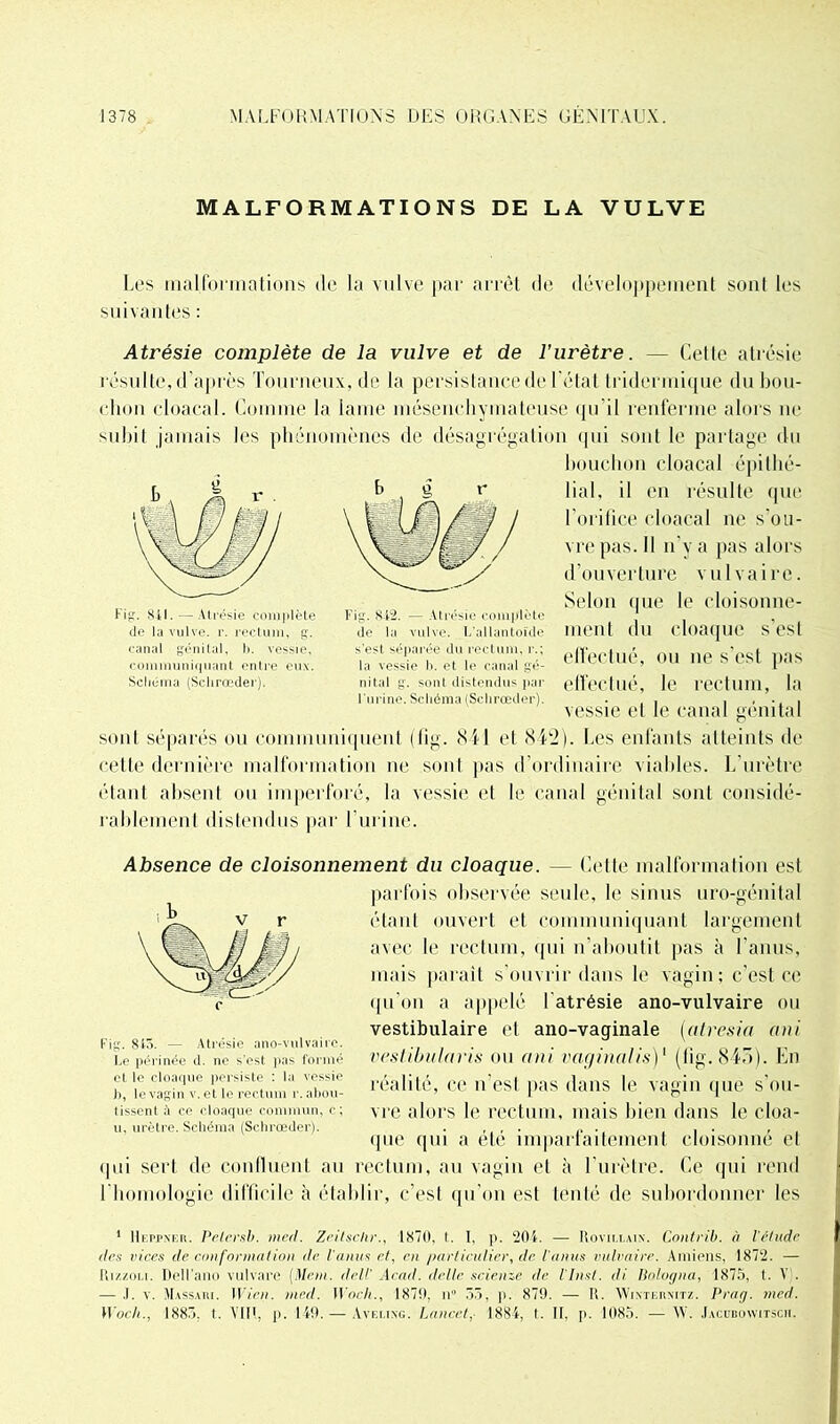 MALFORMATIONS DE LA VULVE Les malformations de la vulve par arrêt de développement sont les suivantes : Atrésie complète de la vulve et de l’urètre. — Cette atrésie résulte, d’après Tourneux,de la persistance de l'état Iridermique du bou- chon cloacal. Comme la lame mésenchymateuse qu'il renferme alors ne subit jamais les phénomènes de désagrégation qui sont le partage du bouchon cloacal épithé- lial, il en résulte que l’orifice cloacal ne s'ou- vre pas. H n v a pas alors d’ouverture vu 1 vaire. Selon que le cloisonne- ment du cloaque s’est effectué, ou ne s'est pas elfeclué, le rectum, la vessie et le canal génital sont séparés ou communiquent (tig. 841 cl 842). Les enfants atteints de cette dernière malformation ne sont pas d’ordinaire viables. L'urètre étant absent ou imperforé, la vessie et le canal génital sont considé- rablement distendus par l’urine. Absence de cloisonnement du cloaque. — Cette malformation est parfois observée seule, le sinus uro-génital étant ouvert et communiquant largement avec le rectum, qui n’aboutit pas à l'anus, mais parait s’ouvrir dans le vagin; c'est ce qu’on a appelé l atrésie ano-vulvaire ou vestibulaire et ano-vaginale [atresia ani vestibularis ou ani vaginalis)' (fig. 845). En réalité, ce n'esl pas dans le vagin que s’ou- vre alors le rectum, mais bien dans le cloa- que qui a été imparfaitement cloisonné et ipii sert de confluent au rectum, au vagin et à l'urètre. Ce qui rend l'homologie difficile à établir, e'esl qu'on est tenté de subordonner les 1 Heppneb. Pelcrsb. med. Zeitschr., 1870, t. I. p. 201. — Rovii.iain. Contrih. à l'élude des vices de conformation de l'anus et, en particulier, (le l'anus vulvaire. Aillions, 1872. — Rizzoli. Dell’ano vulvare (Man. dell’ Acad, délie science de llnsl. di Ilologna, 1875, (. Y . — .1. v. Massahi. Wien. med. Woch., 1870, n° 33, p. 879. — R. AYixturxitz. Praçj. med. Woch., 1883, t. VIH, p. 140. — Avelixg. Lancet, 1884, t. II, p. 1085. — AV. .Iacobowitsch. c Fig. 845. — Atrésie ano-vulvaire. Le périnée d. ne s’est pas formé et le cloaque persiste : la vessie b, le vagin v. et le rectum r. abou- tissent à ce cloaque commun, c; u, urètre. Schéma (Schrœder). Fig. 841. — Atrésie complète de la vulve, r. rectum, g. canal génital, b. vessie, communiquant entre eux. Schéma (Schrœder). Fig. 842. — Atrésie complète de la vulve. L'allantoïde s'est séparée du rectum, r.; la vessie b. et le canal gé- nital g. sont distendus par l'urine. Schéma (Schrœder).