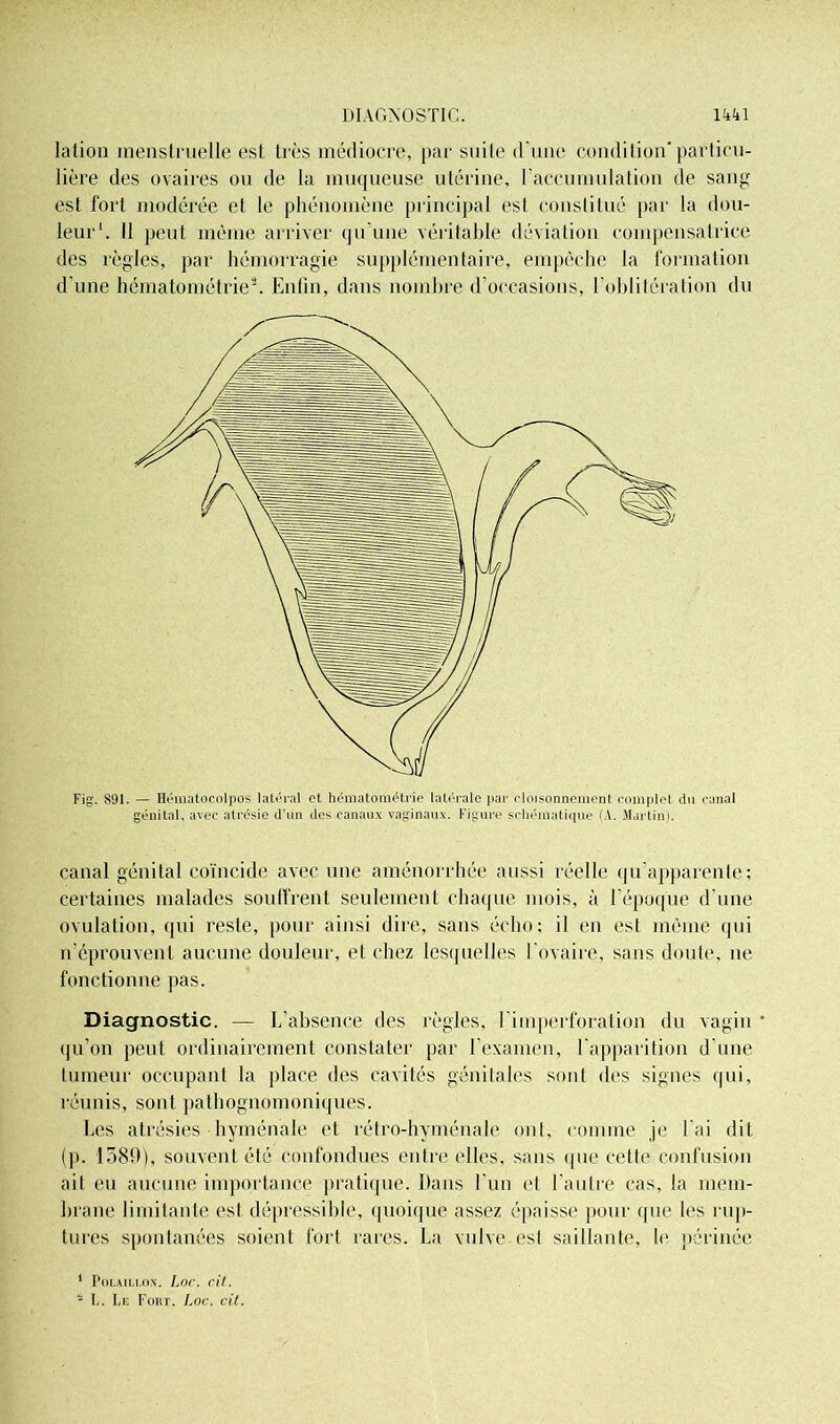 Iation menstruelle est très médiocre, par suite d'une condition'particu- lière des ovaires ou de la muqueuse utérine, l’accumulation de sang est fort modérée et le phénomène principal est constitué par la dou- leur1. Il peut même arriver qu’une véritable déviation compensatrice des règles, par hémorragie supplémentaire, empêche la formation d’une hématométrie2. Enfin, dans nombre d’occasions, l’oblitération du Fig. S91. — Ilématocolpos latéral et hématométrie latérale par cloisonnement complet du canal génital, avec atrésie d'un des canaux vaginaux. Figure schématique (A. Martini. canal génital coïncide avec une aménorrhée aussi réelle qu’apparente; certaines malades souffrent seulement chaque mois, à l’époque d’une ovulation, qui reste, pour ainsi dire, sans écho; il en est même qui n’éprouvent aucune douleur, et chez lesquelles l’ovaire, sans doute, ne fonctionne pas. Diagnostic. — L’absence des règles, l'imperforation du vagin ‘ qu’on peut ordinairement constater par l’examen, l'apparition d’une tumeur occupant la place des cavités génitales sont des signes qui, réunis, sont pathognomoniques. Les atrésies hyménale et rétro-hyménale ont, comme je l’ai dit (p. 1580), souvent été confondues entre elles, sans que cette confusion ait eu aucune importance pratique. Dans l'un et l’autre cas, la mem- brane limitante est dépressible, quoique assez épaisse pour que les rup- tures spontanées soient fort rares. La vulve.est saillante, le périnée 1 Polaili.ox. Loc. cil. - L. Le Fort. Loc. cit.