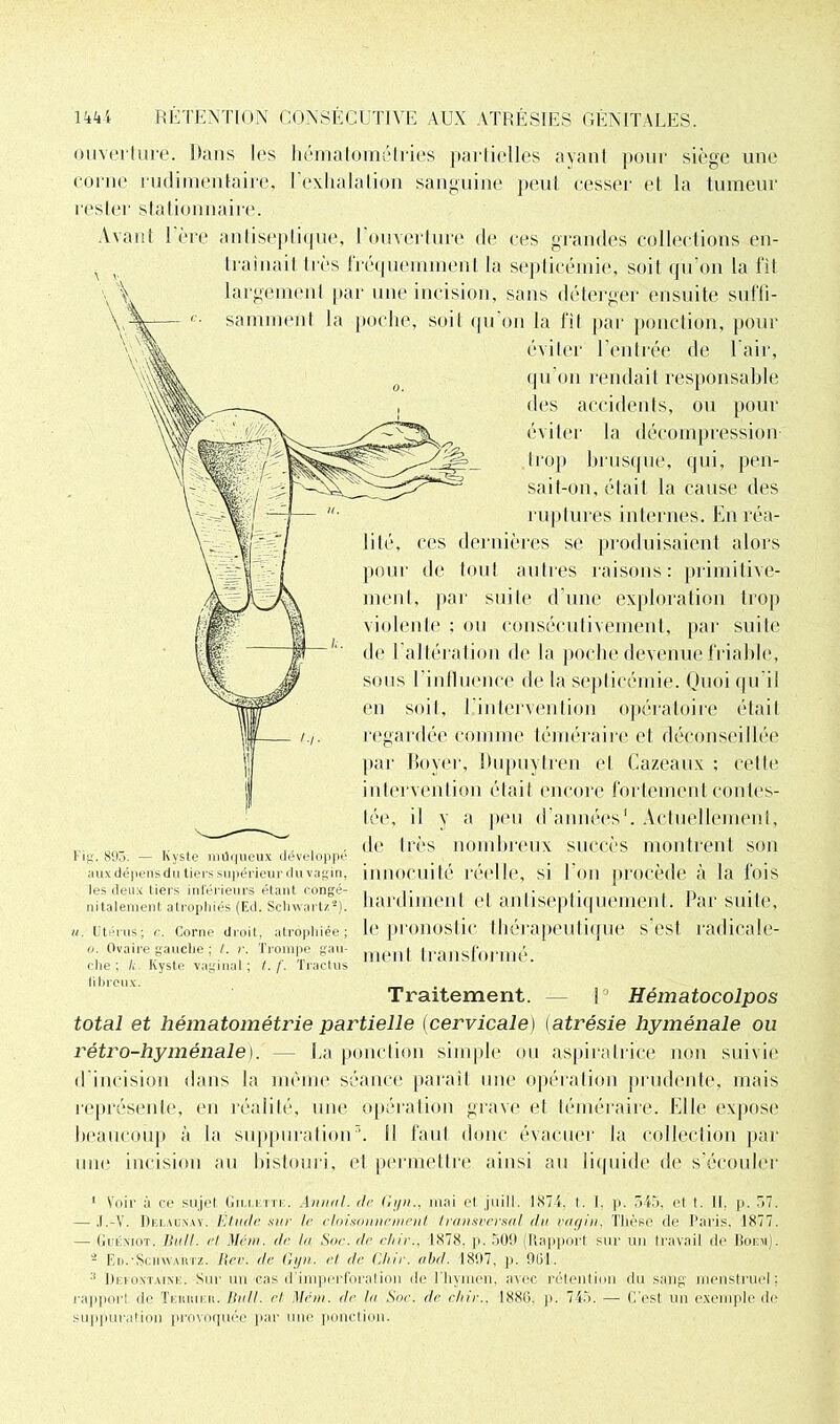 ouverture. Dans les bématométries partielles ayant pour siège une corne rudimentaire, l’exhalation sanguine peut cesser et la tumeur rester stationnaire. Avant ! ère antiseptique, l'ouverture de ces grandes collections en- traînait très fréquemment la septicémie, soit qu’on la fit largement par une incision, sans déterger ensuite suffi- samment la poche, soit qu’on la fit par ponction, pour éviter l’entrée de l’air, qu’on rendait responsable des accidents, ou pour éviter la décompression trop brusque, qui, pen- sait-on, était la cause des ruptures internes. En réa- lité, ces dernières se produisaient alors pour de tout autres raisons: primitive- ment, par suite d’une exploration trop violente : ou consécutivement, par suite de I altération de la poche devenue friable, sous l’inlluence de la septicémie. Quoi qu’il en soit, l'intervention opératoire était regardée comme téméraire et déconseillée par Boyer, Dupuytren et Cazeaux : cette intervention était encore fortement contes- tée, il y a peu d'années1. Actuellement, de très nombreux succès montrent son innocuité réelle, si l'on procède à la fois hardiment et anliseptiquement. Par suite, le pronostic thérapeutique s’est radicale- ment transformé. Fig. 895. — Kyste müqueux développé ;iux dépens du tiers supérieur du vagin, les deux tiers inférieurs étant congé- nitalement atrophiés (Ed. Schwartz*). u. Utérus; c. Corne droit, atrophiée; o. Ovaire gauche ; /. r. Trompe gau- che; li Kyste vaginal; /. f. Trac tus fibreux. Traitement. 1° Hématocolpos total et hématométrie partielle (cervicale) (atrésie hyménale ou rétro-hyménale). La ponction simple ou aspira Irise non suivie d incision dans la même séance parait une opération prudente, mais représente, en réalité, une opération grave et téméraire. Elle expose beaucoup à la suppurationx II faut donc évacuer la collection par une incision an bistouri, et permettre ainsi au liquide de s’écouler 1 Voir à ce sujet Gti.i.ettk. Ann/il. de Ci/n., mai e( juill. 1874. I. I. p. 545, et t. II. p. 57. — ,I.-Y. Di.imj.vu. Etude sui' le cloisonnement transversal du vagin. Thèse de Paris, 1877. — GuÉxroT. Huit, et Mcm. de ta Sur. de chir.. 1878. p. 509 (Rapport sur un travail de Boem). - Eu.'Schwartz. Rev. de Gyn. et de Chir. abd. 1897. p. 901. :l IJefoxtaisk. Sur un cas d imperforalion de l'hymen, avec rétenlion du sang menstruel; rapport de Teruieii. Bail, el Me ni. de la Sur. de chir.. 1880. p. 745. — C’est un exemple de suppuration provoquée par une ponction.