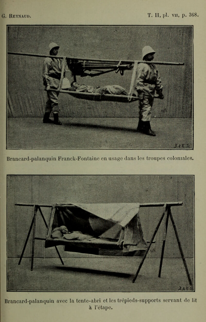 G. Reynauü. T. Il, pl. VII, p. 368, Brancard-palanquin Franck-Fontaine en usage dans les troupes coloniales. Brancard-palan(iuin avec la tente-abri et les trC'pieds-supports servant de lit à rotape.