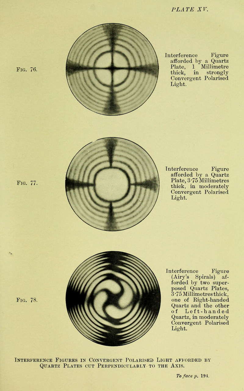 Fig. 76. Interference Figure afforded by a Quartz Plate, 1 Millimetre thick, in strongly Convergent Polarised Light. Fig. 77. Interference Figure afforded by a Quartz Plate, 3 75 Millimetres thick, in moderately Convei’gent Polarised Light. Fig. 78. Interference Figure (Airy’s Spirals) af- forded by two super- posed Quartz Plates, 375 Millimetres thick, one of Right-handed Quartz and the other of Left-handed Quai’tz, in moderately Convergent Polarised Light. Interference Figures in Convergent Polarised Light afforded by Quartz Plates cut Perpendicularly to the Axis.