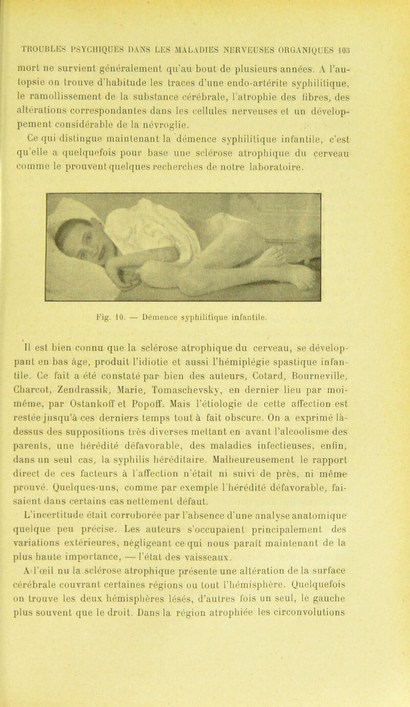 niort ne survient generalement qu’au bout de plusieurs annees. A l’au- lopsie on trouve d'habitude les traces d’une endo-arlerite syphilitique, le ramollissement de la substance cerebrate, l’atrophie des fibres, des alterations correspondantes dans les cellules nerveuses el un develop- pement considerable de la nevroglie. Ce qui distingue mainlenant la demence syphilitique infantile, c’est qu’elle a quelquefois pour base une sclerose atrophique du cerveau coniine le prouvent quelques recherches de notre laboratoire. Fig. 10. — Demence syphilitique infantile. 11 est bien connu que la sclerose atrophique du cerveau, se develop- panl en bas age, produit l’idiotie et aussi l’hemiplegie spastique infan- tile. Ce fait a ete constate par bien des auteurs, Cotard, Bourneville, Charcot, Zendrassik, Marie, Tomaschevsky, en dernier lieu par inoi- meme, par Ostankoff et Popofif. Mais l’etiologie de cette affection est restee jusqu’a ces derniers temps tout h fait obscure. On a exprime lk- dessus des suppositions tres diverses mettant en avanl l’alcoolisme des parents, une heredite defavorable, des maladies infectieuses, enfin, dans un seul cas, la syphilis hereditaire. Malheureusement le rapport direct de ces facteurs a l affection n’etail. ni suivi de pres, ni m6me prouve. Quelques-uns, comme par exemple 1 lieredite defavorable, fai- saient dans certains cas nettement defaul. L’incertitude etait corroboree par l’absence d’une analyse analomique quelque peu precise. Les auteurs s’occupaient principalement des variations exlerieures, negligeant ce qui nous parait mainlenant de la plus haute importance, — l'elal des vaisseaux. A l’ceil nu la sclerose atrophique presente une alteration de la surface cerebrale couvrant certaines regions ou tout l’hemisphere. Quelquefois on trouve les deux hemispheres leses, d’autres fois un seul, le gauche plus souvenl que le droit. Dans la region alrophiee les circonvolulions