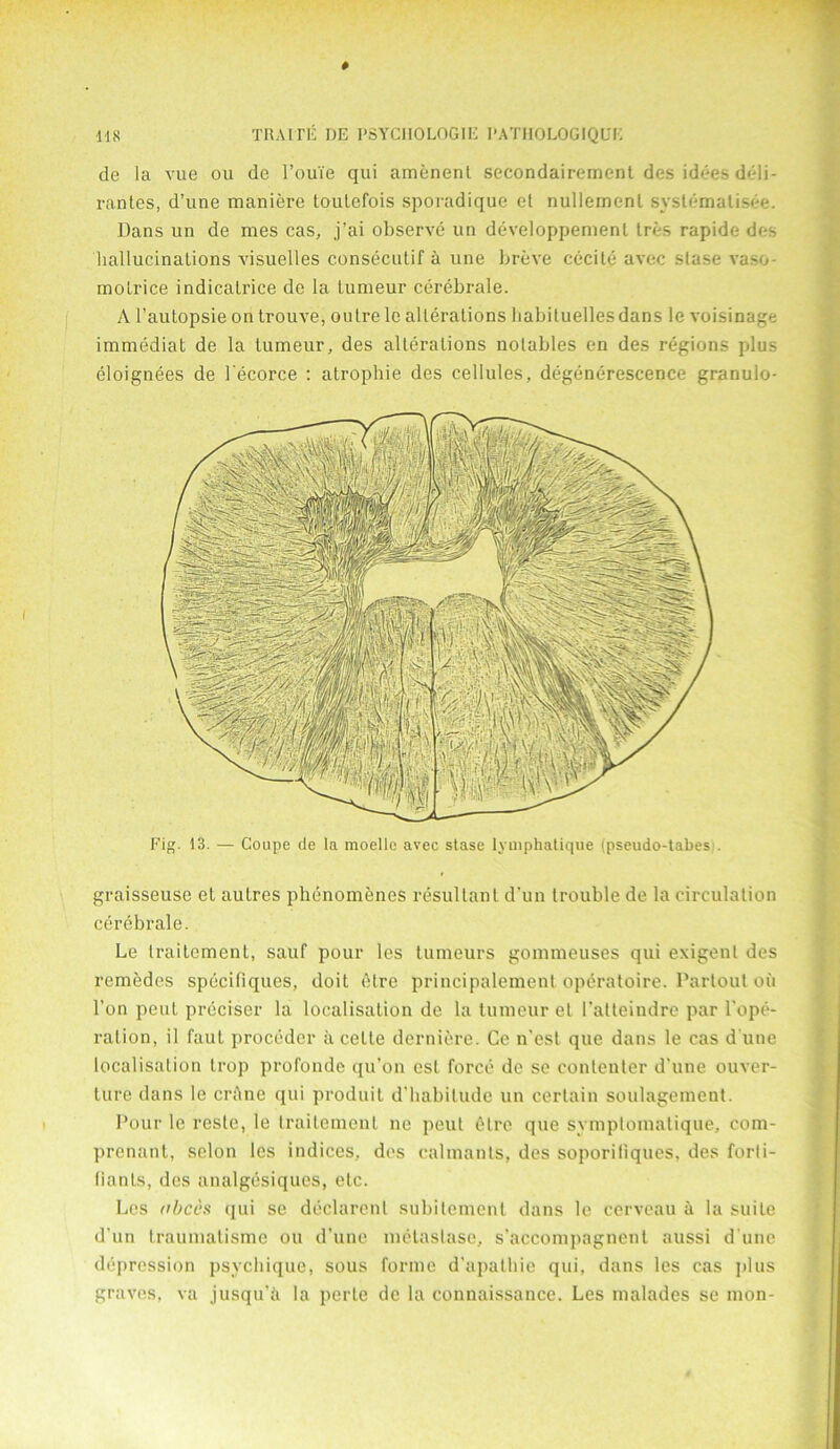 de la vue ou de 1’ouTe qui amenent secondairement des idees deli- rantes, d’une maniere toulefois sporadique et nullemenl systematisee. Dans un de mes cas, j’ai observe un developpemenl tres rapide des hallucinations visuelles consecutif a une breve cecite avec slase va-o- motrice indicalrice de la tumeur cerebrale. A l’autopsie on trouve, outre le alterations liabituellesdans le voisinage immediat de la tumeur, des alterations notables en des regions plus eloignees de l'ecorce : atrophie des cellules, degenerescence granulo- graisseuse el autres phenomenes resultant d’un trouble de la circulation cerebrale. Le Iraitement, sauf pour les tumeurs gommeuses qui exigent des remedcs specifiques, doit etre principalement opcratoire. Dartout ou Ton peut prcciser la localisation de la tumeur et I’atteindre par l’ope- ration, il faut proceder a cette derniere. Ce n'est que dans le cas d une localisation trop profonde qu’on esl force de se contenter d'une ouver- lure dans le crAne qui produit d’habilude un certain soulagement. Pour le reste, le Iraitement lie peut etre que symplomalique, com- prenant, scion les indices, des ealmanls, des soporiliques, des forii- fiants, des analgesiques, etc. Les cbccs qui se declarenl subilement dans le cerveau a la suite d'un traumalismc ou d’une metastase, s'accompagnent aussi d une depression psychique, sous forme d’apalbie qui, dans les cas plus graves, va jusqu'A la perte de la connaissance. Les malades se mon- Coupe de la moellc avec stase lymphatique (pseudo-tabes-. FiK. 13.