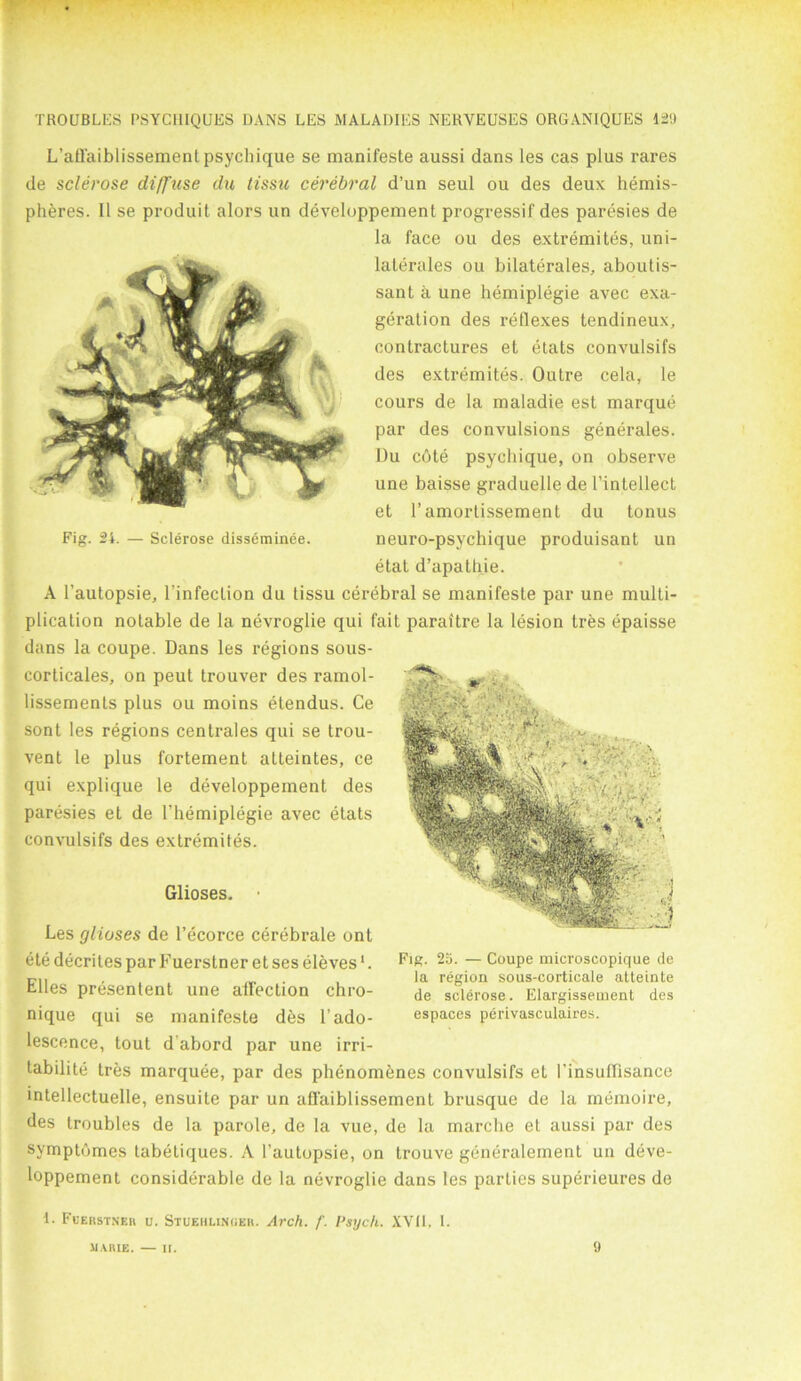 L’afTaiblissementpsychique se manifeste aussi dans les cas plus rares de sclerose diffuse du tissu cerebral d’un seul ou des deux hemis- pheres. 11 se produit alors un developpement progressif des paresies de la face ou des extremites, uni- lalerales ou bilaterales, aboutis- sant a une hemiplegie avec exa- geration des reflexes tendineux, contractures et etats convulsifs des extremites. Outre cela, le cours de la maladie est marque par des convulsions generates. Du cote psychique, on observe une baisse graduelle de l’intellect et l’amorlissement du tonus Fig. 24. — Sclerose disseminee. neuro-psychique produisant un etat d’apathie. A l’autopsie, l’infection du tissu cerebral se manifeste par une multi- plication notable de la ncvroglie qui fait paraitre la lesion Ires epaisse dans la coupe. Dans les regions sous- corticales, on peut trouver des ramol- lissemenls plus ou moins etendus. Ce sont les regions centrales qui se trou- vent le plus fortement atteintes, ce qui explique le developpement des paresies et de l’liemiplegie avec etats convulsifs des extremites. Glioses. • Les glioses de l’ecorce cerebrate ont ete decrites par Fuerstner et ses eleves1. Elies presentent une affection chro- nique qui se manifeste des 1’ado- lescence, tout d abord par une irri- tability tres marquee, par des phenomenes convulsifs et I’insuffisance intellectuelle, ensuite par un afl'aiblissement brusque de la memoire, des troubles de la parole, de la vue, de la marche et aussi par des symptumes tabetiques. A l’autopsie, on trouve generalement un deve- loppement considerable de la nevroglie dans les parties superieures de 1. Fberstneh o. Stuehlinger. Arch. f. Psych. XVII, I. Fig. 23. — Coupe microscopique de la region sous-corticale atteinte de sclerose. Elargissement des espaces perivasculaires. MARIE. — II. 9