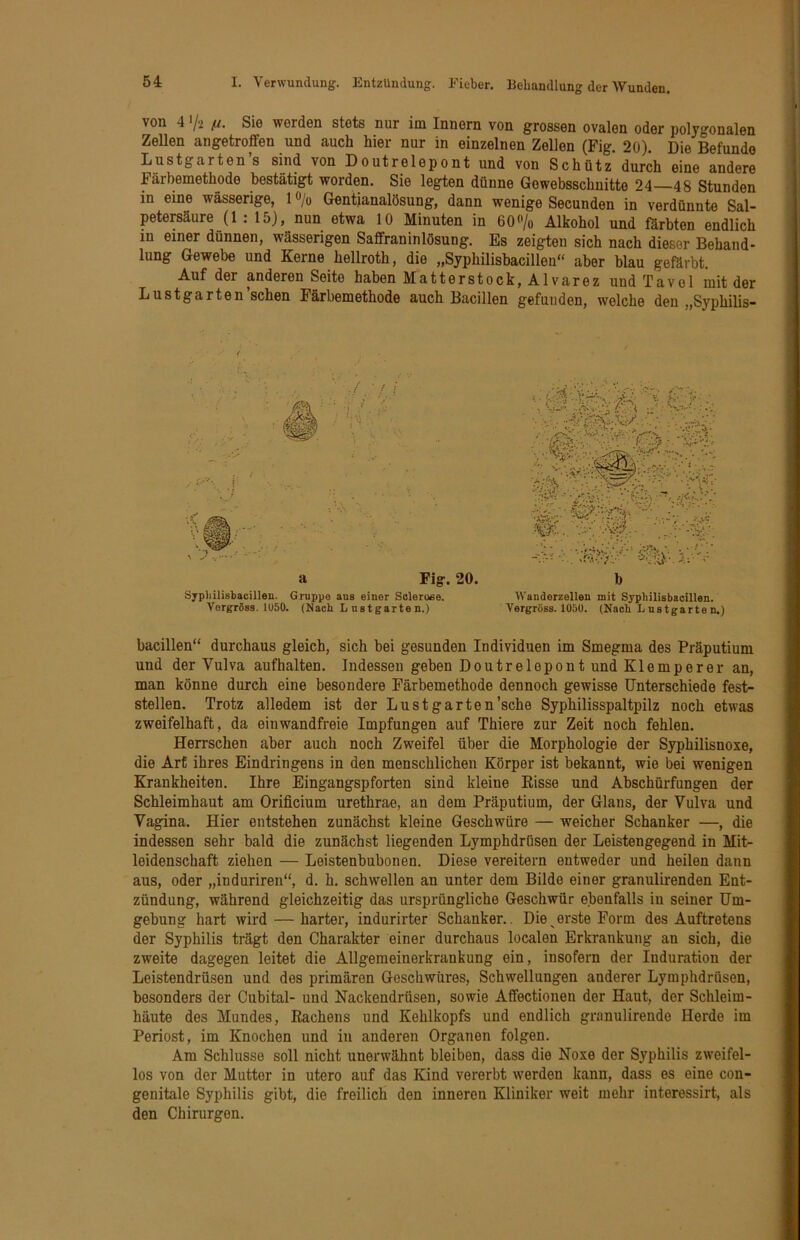 von 4 V2 fi. Sie werden stets nur im Innern von grossen ovalen oder polygonalen Zellen angetroffen und auch hier nur in einzelnen Zellen (Fig. 20). Die Befunde Lustgarten s sind von Doutrelepont und von Schütz durch eine andere Färbemethode bestätigt worden. Sie legten dünne Gewebsschuitte 24—48 Stunden in eine wässerige, 1 o/o Gentianalösung, dann wenige Secunden in verdünnte Sal- petersäure (1:15), nun etwa 10 Minuten in 60«/o Alkohol und färbten endlich in einer dünnen, wässerigen Saffraninlösung. Es zeigten sich nach dieser Behand- lung Gewebe und Kerne hellroth, die „Syphilisbacilleu“ aber blau gefärbt. Auf der anderen Seite haben Matterstock, Alvarez und Tavel mit der Lustgarten sehen Färbemethode auch Bacillen gefunden, welche den „Syphilis- a Fig. 20. b Sypliilisbacillen. Gruppe aus einer Soleroee. Wanderzellen mit Sypliilisbacillen. Vorgrösa. 1U50. (Nach Lustgarten.) Vergröss. 1050. (Nach Lustgarten.) bacillen“ durchaus gleich, sich bei gesunden Individuen im Smegma des Präputium und der Vulva aufhalten. Indessen geben Doutrelepont und Klemperer an, man könne durch eine besondere Färbemethode dennoch gewisse Unterschiede fest- stellen. Trotz alledem ist der Lustgarten’sche Syphilisspaltpilz noch etwas zweifelhaft, da einwandfreie Impfungen auf Thiere zur Zeit noch fehlen. Herrschen aber auch noch Zweifel über die Morphologie der Syphilisnoxe, die Art ihres Eindringens in den menschlichen Körper ist bekannt, wie bei wenigen Krankheiten. Ihre Eingangspforten sind kleine Eisse und Abschürfungen der Schleimhaut am Orificium urethrae, an dem Präputium, der Glaus, der Vulva und Vagina. Hier entstehen zunächst kleine Geschwüre — weicher Schanker —, die indessen sehr bald die zunächst liegenden Lymphdrüsen der Leistengegend in Mit- leidenschaft ziehen — Leistenbubonen. Diese vereitern entweder und heilen dann aus, oder „induriren“, d. h. schwellen an unter dem Bilde einer granulirenden Ent- zündung, während gleichzeitig das ursprüngliche Geschwür ebenfalls in seiner Um- gebung hart wird — harter, indurirter Schanker.. Biederste Form des Auftretens der Syphilis trägt den Charakter einer durchaus localen Erkrankung an sieh, die zweite dagegen leitet die Allgeraeinerkrankung ein, insofern der Induration der Leistendrüsen und des primären Geschwüres, Schwellungen anderer Lymphdrüsen, besonders der Cubital- und Nackendrüsen, sowie Affectionen der Haut, der Schleim- häute des Mundes, Rachens und Kehlkopfs und endlich granulirende Herde im Periost, im Knochen und in anderen Organen folgen. Am Schlüsse soll nicht unerwähnt bleiben, dass die Noxe der Syphilis zweifel- los von der Mutter in utero auf das Kind vererbt werden kann, dass es eine con- genitale Syphilis gibt, die freilich den inneren Kliniker weit mehr interessirt, als den Chirurgen.