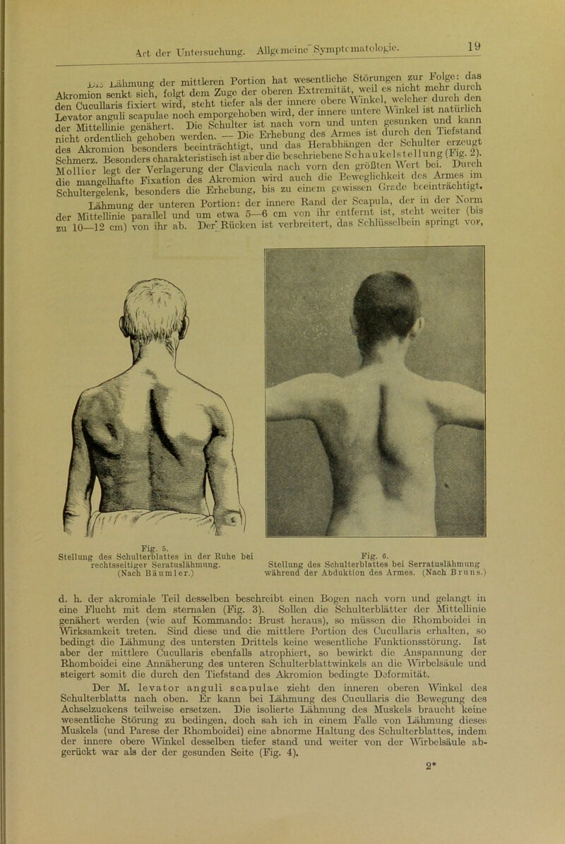 ^ Ebnung der mittleren Portion hat wesentliche Störungen zur Folge: das Akromion senkt sich, folgt dem Zuge der oberen Extremitätfe, wer. ciJ ^ rtpn Cucullaris fixiert wird, steht tiefer als der innere obere Winkel, welcher auicn aen Levator anguli scapulae noch emporgehoben wird, der innere untere Winkel ist natürlich der Mittellinie genähert. Die Schulter ist nach vorn und unten gesunken und kann nicht ordentlich gehoben werden. — Die Erhebung des Armes ist durch den Tiefstand des Akromion besonders beeinträchtigt und das Herabhangen der Schulter erzeug Schmerz. Besonders charakteristisch ist aber die beschriebene Schaukels tellung (Ug. _ . Mollier legt der Verlagerung der Clavicula nach vorn den größten Wert bei. Durch die mangelhafte Fixation des Akromion wird auch che Beweglichkeit des _ Armes im Schultergelenk, besonders die Erhebung, bis zu einem gewissen Grade beeinträchtigt. Lähmung der unteren Portion: der innere Rand der Scapula, der in der Vorm der Mittellinie parallel und um etwa 5—6 cm von ihr entfernt ist, steht weiter (bis zu jo 12 cm) von ihr ab. Der’ Rücken ist verbreitert, das Schlüsselbein springt \ or. Fig. 6. Stellung des Schulterblattes in der Ruhe bei rechtsseitiger Seratuslähmnng. (Nach Bäumler.) Fig. 0. Stellung des Schulterblattes bei Serratusliihnmng während der Abduktion des Armes. (Nach Bruns.) d. h. der akromiale Teil desselben beschreibt einen Bogen nach vorn und gelangt in eine Flucht mit dem sternalen (Fig. 3). Sollen die Schulterblätter clor Mittellinie genähert werden (wie auf Kommando: Brust heraus), so müssen die Rhomboidei in Wirksamkeit treten. Sind diese und die mittlere Portion des Cucullaris erhalten, so bedingt die Lähmung des untersten Drittels keine wesentliche Funktionsstörung. Ist aber der mittlere Cucullaris ebenfalls atrophiert, so bewirkt die Anspannung der Rhomboidei eine Annäherung des unteren Schulterblattwinkels an die Wirbelsäule und steigert somit die durch den Tiefstand des Akromion bedingte Deformität. Der M. levator anguli scapulae zieht den inneren oberen Winkel des Schulterblatts nach oben. Er kann bei Lähmung eles Cucullaris die Bewegung des Achselzuckens teilweise ersetzen. Die isolierte Lähmung des Muskels braucht keine wesentliche Störung zu bedingen, doch sah ich in einem Falle von Lähmung dieses Muskels (und Parese der Rhomboidei) eine abnorme Haltung des Schulterblattes, indem der innere obere Winkel desselben tiefer stand und weiter von der Wirbelsäule ab- gerückt war als der der gesunden Seite (Fig. 4). 2*