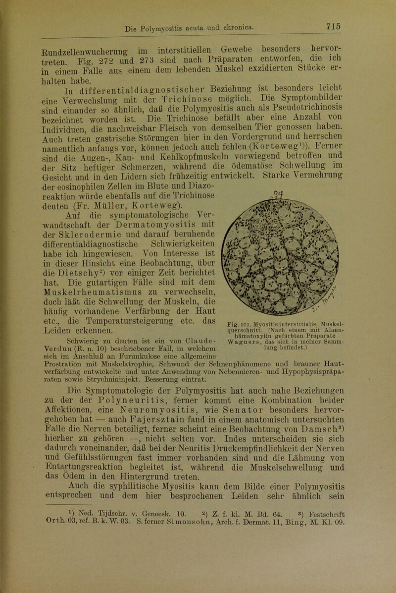 Rundzellenwucherung im interstitiellen Gewebe besonders hervor- treten. Fig. 272 und 273 sind nach Präparaten entworfen, die ich in einem Falle aus einem dem lebenden Muskel exzidierten Stücke er- halten habe. . In differentialdiagnostischer Beziehung ist besonders leicht eine Verwechslung mit der Trichinose möglich. Die Symptombilder sind einander so ähnlich, daß die Polymyositis auch als Pseudotiichinosis bezeichnet worden ist. Die Trichinose befällt aber eine Anzahl von Individuen, die nachweisbar Fleisch von demselben Tier genossen haben. Auch treten gastrische Störungen hier in den Vordergrund und herrschen namentlich anfangs vor, können jedoch auch fehlen (Korteweg1)). Ferner sind die Augen-, Kau- und Kehlkopfmuskeln vorwiegend betroffen und der Sitz heftiger Schmerzen, während die ödematöse Schwellung im Gesicht und in den Lidern sich frühzeitig entwickelt. Starke Vermehrung der eosinophilen Zellen im Blute und Diazo- reaktion würde ebenfalls auf die Trichinose deuten (Fr. Müller, Korteweg). Auf die symptomatologische Ver- wandtschaft der Dermatomyositis mit der Sklerodermie und darauf beruhende differentialdiagnostische Schwierigkeiten habe ich hingewiesen. Von Interesse ist in dieser Hinsicht eine Beobachtung, über die Dietschy2) vor einiger Zeit berichtet hat. Die gutartigen Fälle sind mit dem Muskelrheumatismus zu verwechseln, doch läßt die Schwellung der Muskeln, die häufig vorhandene Verfärbung der Haut etc., die Temperatursteigerung etc. das Fi(?.27).My0sitisinterstitiaiis. Muskel- Leiden erkennen. querschnitt. (Nach einem mit Alaun- . hämatoxylin gefärbten Präparate Schwierig zu deuten ist ein von Claude- Wagners, das sich in meiner Samm- Verdun (R. n. 10) beschriebener Fall, in welchem lunS befindet.) sich im Anschluß an Furunkulose eine allgemeine Prostration mit Muskelatrophie, Schwund der Sehnenphänomene und brauner Haut- verfärbung entwickelte und unter Anwendung von Nebennieren- und Hypophysispräpa- raten sowie Strychnininjekt. Besserung eintrat. Die Symptomatologie der Polymyositis hat auch nahe Beziehungen zu der der Polyneuritis, ferner kommt eine Kombination beider Affektionen, eine Neuromyositis, wie Senator besonders hervor- gehoben hat — auch Fajersztain fand in einem anatomisch untersuchten Falle die Nerven beteiligt, ferner scheint eine Beobachtung von Dänisch3) hierher zu gehören —, nicht selten vor. Indes unterscheiden sie sich dadurch voneinander, daß bei der Neuritis Druckempfindlichkeit der Nerven uud Gefühlsstörungen fast immer vorhanden sind und die Lähmung von Entartungsreaktion begleitet ist, während die Muskelschwellung und das Ödem in den Hintergrund treten. Auch die syphilitische Myositis kann dem Bilde einer Polymyositis entsprechen und dem hier besprochenen Leiden sehr ähnlich sein B Ned. Tijdscbr. v. Geneesk. 10. 2) z. f. kl. M. Bd. 64. 3) Festschrift Orth. 03, ref. B. k. W. 03. S. ferner Simonsohn, Arch. f. Dermat. 11, Bing, M. Kl. 09.
