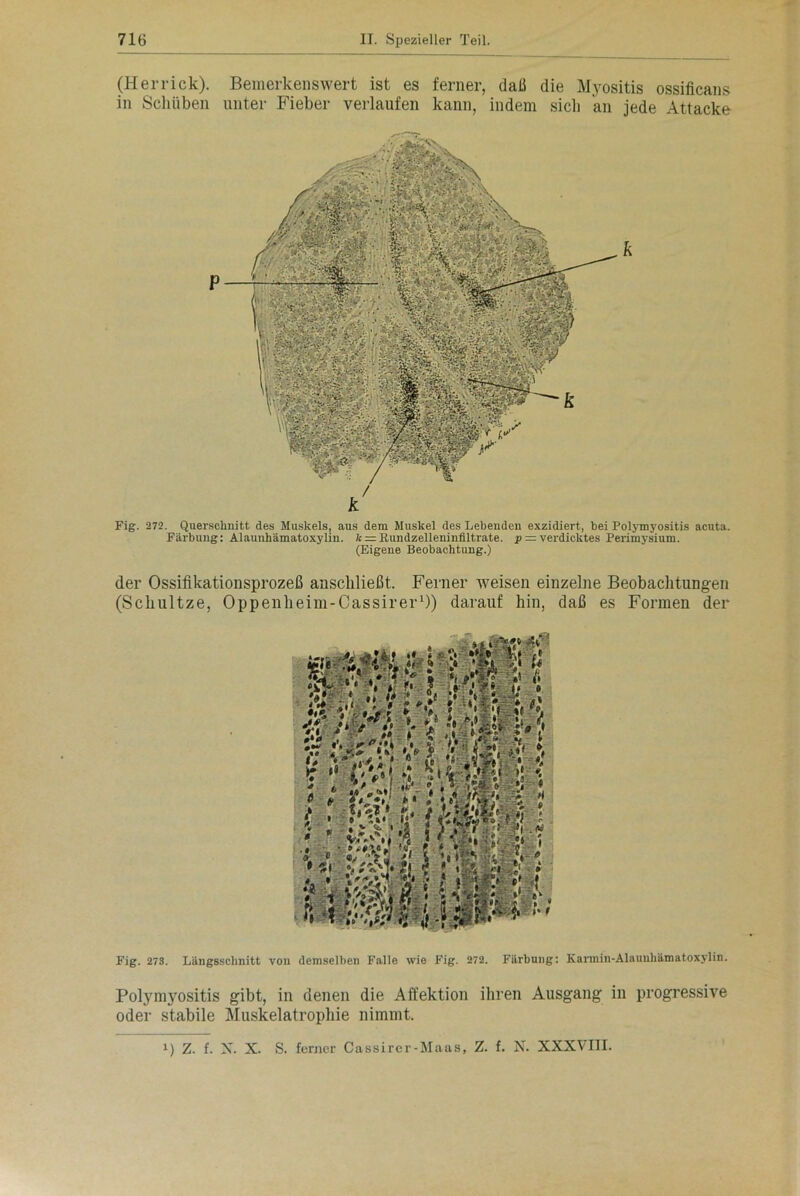 (Herrick). Bemerkenswert ist es ferner, daß die Myositis ossificans in Schüben unter Fieber verlaufen kann, indem sich an jede Attacke Fig. 272. Querschnitt des Muskels, aus dem Muskel des Lebenden exzidiert, hei Polymyositis acuta. Färbung: Alaunhämatoxylin. k = Rundzelleninfiltrate. p = verdicktes Perimysium. (Eigene Beobachtung.) der Ossifikationsprozeß anscliließt. Ferner weisen einzelne Beobachtungen (Schultze, Oppenheim-Cassirer1)) darauf hin, daß es Formen der Fig. 273. Längsschnitt von demselben Falle wie Fig. 272. Färbung: Karmin-Alaunhämatoxylin. Polymyositis gibt, in denen die Affektion ihren Ausgang in progressive oder stabile Muskelatrophie nimmt. i) Z. f. X. X. S. ferner Cassirer-Maas, Z. f. N. XXXVIII.