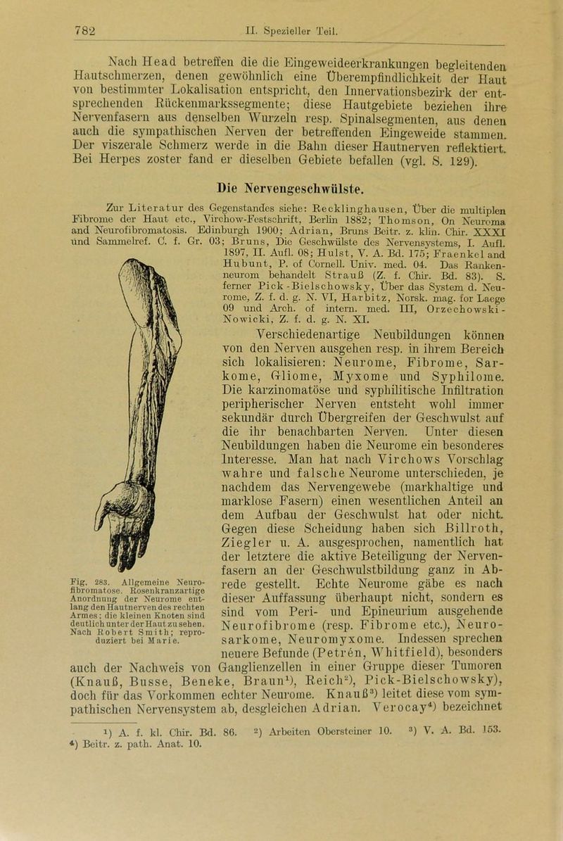 Nach Head betreffen die die Eingeweideerkrankungen begleitenden Hautschmerzen, denen gewöhnlich eine Überempfindlichkeit der Haut von bestimmter Lokalisation entspricht, den Innervationsbezirk der ent- sprechenden Rückenmarkssegmente; diese Hautgebiete beziehen ihre Nervenfasern aus denselben Wurzeln resp. Spinalsegmenten, aus denen auch die sympathischen Nerven der betreffenden Eingeweide stammen. Der viszerale Schmerz werde in die Bahn dieser Hautnerven reflektiert.* Bei Herpes zoster fand er dieselben Gebiete befallen (vgl. S. 129). Die Nervengescliwiilste. Zur Literatur des Gegenstandes siehe: Recklinghausen, Über die multiplen Fibrome der Haut etc., Virckow-Festschrift, Berlin 1882; Thomson, On Neuroma and Neurofibromatosis. Edinburgh 1900; Adrian, Bruns Beitr. z. klin. Chir. XXTT Und Sammelref. C. f. Gr. 03; Bruns, Die Geschwülste des Nervensystems, I. Aufl. 1897, II. Aufl. 08; Hulst, V. A. Bd. 175; Fraenkel and Hu bunt, P. of Cornell. üniv. med. 04. Das Ranken- neurom behandelt Strauß (Z. f. Chir. Bd. 83). S. ferner Pick-Bielschowsky, Über das System d. Neu- rome, Z. f. d. g. N. VI, Harbitz, Norsk. mag. for Laege 09 und Arch. of intern, med. III, Orzechowski- Nowicki, Z. f. d. g. N. XI. Verschiedenartige Neubildungen können von den Nerven ausgehen resp. in ihrem Bereich sich lokalisieren: Neurome, Fibrome, Sar- kome, Gliome, Myxome und Syphilome. Die karzinomatöse und syphilitische Infiltration peripherischer Nerven entsteht wohl immer sekundär durch Übergreifen der Geschwulst auf die ihr benachbarten Nerven. Unter diesen Neubildungen haben die Neurome ein besonderes Interesse. Man hat nach Virchows Vorschlag wahre und falsche Neurome unterschieden, je nachdem das Nervengewebe (markhaltige und marklose Fasern) einen wesentlichen Anteil au dem Aufbau der Geschwulst hat oder nicht. Gegen diese Scheidung haben sich Billroth, Ziegler u. A. ausgesprochen, namentlich hat der letztere die aktive Beteiligung der Nerven- fasern an der Geschwulstbildung ganz in Ab- rede gestellt. Echte Neurome gäbe es nach dieser Auffassung überhaupt nicht, sondern es sind vom Peri- und Epineurium ausgehende Neurofibrome (resp. Fibrome etc.), Neuro- sarkome, Neuromyxome. Indessen sprechen neuere Befunde (Petren, Whitfield), besonders auch der Nachweis von Ganglienzellen in einer Gruppe dieser Tumoren (Knauß, Busse, Beneke, Braun1), Reich2), Pick-Bielschowsky), doch für das Vorkommen echter Neurome. Knauß3) leitet diese vom sym- pathischen Nervensystem ab, desgleichen Adrian. Verocay4) bezeichnet 2) Arbeiten Obersteiner J 0. 3) V. A. Bd. >53. Fig, 283. Allgemeine Neuro- fibromatose. Rosenkranzartige Anordnung der Neurome ent- lang den Hautnerven des rechten Armes: die kleinen Knoten sind deutlich unter der Haut zu sehen. Nach Robert Smith; repro- duziert bei Marie. i) A. f. kl. Chir. Bd. 86. 4) Beitr. z. path. Anat. 10.