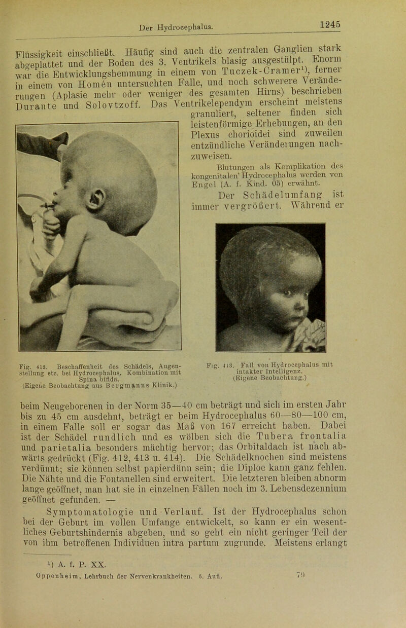 1245 Flüssigkeit einschließt. Häufig sind auch die zentralen Ganglien stark abgeplattet und der Boden des 3. Ventrikels blasig ausgestulpt Enorm war die Entwicklungshemmung in einem von Tuczek-Cramer ), teinei in einem von Homen untersuchten Falle, und noch schwerere Verände- rungen (Aplasie mehr oder weniger des gesamten Hirns) beschrieben Durante und Solovtzoff. Das Ventrikelependym erscheint meistens granuliert, seltener finden sich leistenförmige Erhebungen, an den Plexus chorioidei sind zuweilen entzündliche Veränderungen nach- zuweisen. Blutungen als Komplikation des kongenitalen' Hydrocepkalus werden von Engel (A. f. Kind. 05) erwähnt. Der Schädelumfang ist immer vergrößert. Während er Fig. 412. Beschaffenheit des Schädels, Augen- stellung etc. hei Hydrocephalus, Kombination mit Spina bifida. (Eigene Beobachtung aus Bergmanns Klinik.) Fig. 413. Fall von Hydrocephalus mit intakter Intelligenz. (Eigene Beobachtung.) beim Neugeborenen in der Norm 35—40 cm beträgt und sich im ersten Jahr bis zu 45 cm ausdehnt, beträgt er beim Hydrocephalus 60—80—100 cm, in einem Falle soll er sogar das Maß von 167 erreicht haben. Dabei ist der Schädel rundlich und es wölben sich die Tubera frontalia und parietalia besonders mächtig hervor; das Orbitaldach ist nach ab- wärts gedrückt (Fig. 412, 413 u. 414). Die Schädelknochen sind meistens verdünnt; sie können selbst papierdünu sein; die Diploe kann ganz fehlen. Die Nähte und die Fontanellen sind erweitert. Die letzteren bleiben abnorm lange geöffnet, man hat sie in einzelnen Fällen noch im 3. Lebensdezennium geöffnet gefunden. — Symptomatologie und Verlauf. Ist der Hydrocephalus schon bei der Geburt im vollen Umfange entwickelt, so kann er ein wesent- liches Geburtshindernis abgeben, und so geht ein nicht geringer Teil der von ihm betroffenen Individuen intra partum zugrunde. Meistens erlangt >) A. f, P. XX.