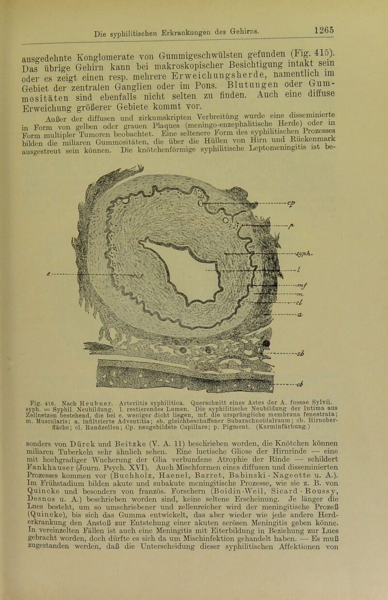 ausgedehnte Konglomerate von Gummigeschwtilsten gefunden (Fig. 415). Das& übrige Gehirn kann bei makroskopischer Besichtigung intakt sein oder es zeigt einen resp. mehrere Erweichungsherde, namentlich im Gebiet der zentralen Ganglien oder im Pons. Blutungen oder Gum- mositäten sind ebenfalls nicht selten zu finden. Auch eine diffuse Erweichung größerer Gebiete kommt vor. Außer der diffusen und zirkumskripten Verbreitung wurde eine disseminierte in Form von gelben oder grauen Plaques (meningo-enzephahtische Herde) oder in Form multipler Tumoren beobachtet. Eine seltenere Form des syphilitischen Prozesses bilden die miliaren Gummositäten, die über die Hüllen von Hirn und Rückenmark ausgestreut sem können. Die knötchenförmige syphilitische Leptomeningitis ist be- Fig. 416. Nach Heubner. Arteriitis syphilitica. Querschnitt eines Astes der A. fossae Sylvii. syph. = Syphil. Neubildung. 1. restierendes Lumen. Die syphilitische Neubildung der Intima aus Zellnetzen bestehend, die bei e. weniger dicht liegen, mf. die ursprüngliche membrana fenestrata; m. Muscularis; a. infiltrierte Adventitia; sb. gleichbeschaffener Subarachnoidalraum; cb. Hirnober- fläche; cl. Rundzellen; Cp. neugebildete Capillare; p. Pigment. (Karminfärbung.) sonders von Dürck und Beitzke (V. A. 11) beschrieben worden, die Knötchen können miliaren Tuberkeln sehr ähnlich sehen. Eine luetische Gliose der Hirnrinde -— eine mit hochgradiger Wucherung der Glia verbundene Atrophie der Rinde — schildert Fankhauser (Joum. Psych. XVI). Auch Mischformen eines diffusen und disseminierten Prozesses kommen vor (Buchholz, Haenel, Barret, Babinski - Nageotte u. A.). Im Frühstadium bilden akute und subakute meningitische Prozesse, wie sie z. B. von Quincke und besonders von französ. Forschern (Boidin-Weil, Sicard - Roussy, Desnos u. A.) beschrieben worden sind, keine seltene Erscheinung. Je länger die Lues besteht, um so umschriebener und zellenreicher wird der meningitische Prozeß (Quincke), bis sich das Gumma entwickelt, das aber wieder wie jede andere Herd- erkrankung den Anstoß zur Entstehung einer akuten serösen Meningitis geben könne. In vereinzelten Fällen ist auch eine Meningitis mit Eiterbildung in Beziehung zur Lues gebracht worden, doch dürfte es sich da um Mischinfektion gehandelt haben. — Es muß zugestanden werden, daß die Unterscheidung dieser syphilitischen Affektionen von