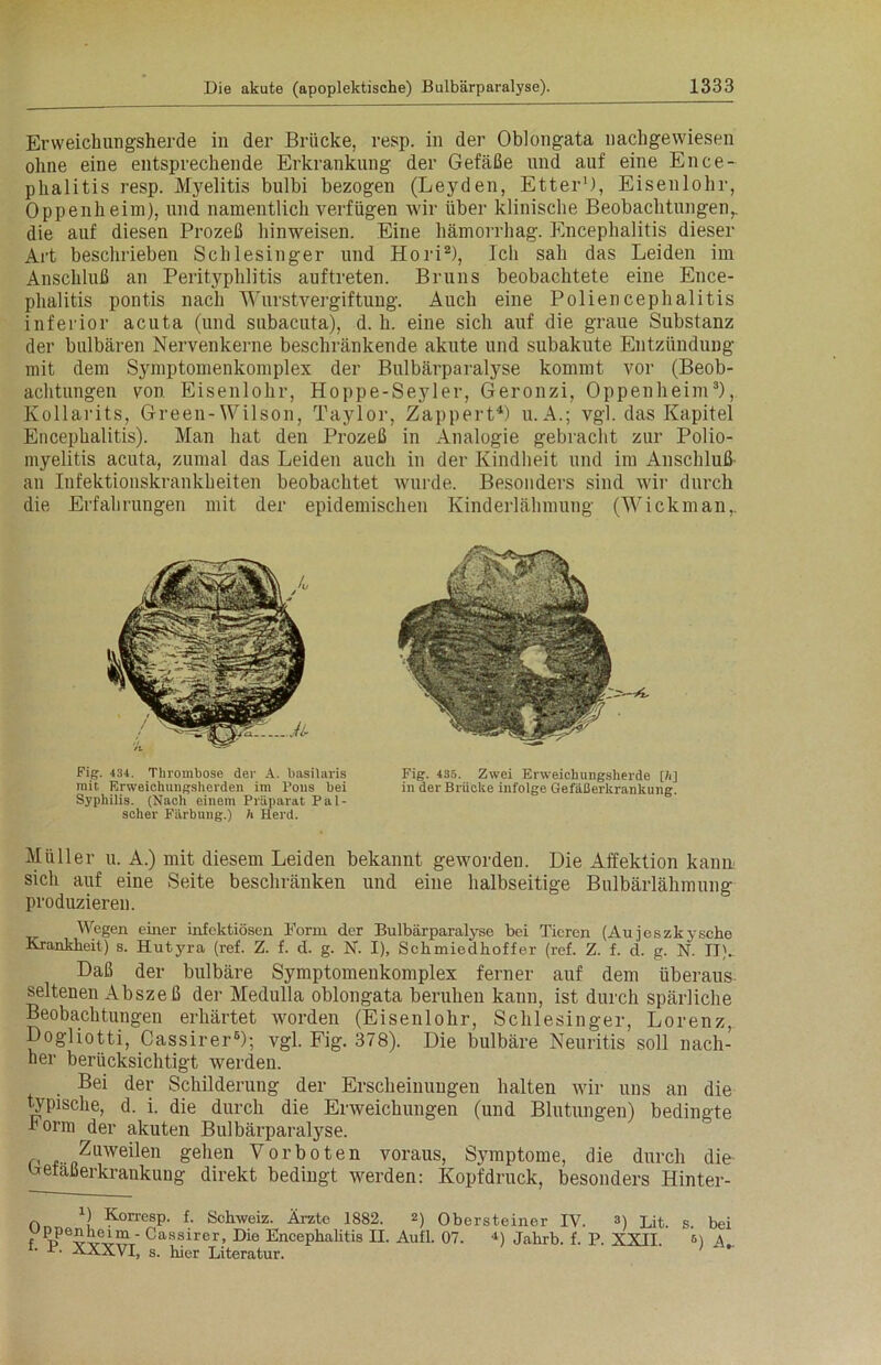 Erweichungsherde in der Brücke, resp. in der Oblongata nachgewiesen ohne eine entsprechende Erkrankung der Gefäße und auf eine Ence- phalitis resp. Myelitis bulbi bezogen (Leyden, Etter1), Eisenlohr, Oppenheim), und namentlich verfügen wir über klinische Beobachtungen,, die auf diesen Prozeß hinweisen. Eine hämorrhag. Encephalitis dieser Art beschrieben Schlesinger und Hori2), Ich sah das Leiden im Anschluß an Perityphlitis auftreten. Bruns beobachtete eine Ence- phalitis pontis nach Wurstvergiftung. Auch eine Poliencephalitis inferior acuta (und subacuta), d. h. eine sich auf die graue Substanz der bulbären Nervenkerne beschränkende akute und subakute Entzündung mit dem Symptomenkomplex der Bulbärparalyse kommt vor (Beob- achtungen von Eisenlohr, Hoppe-Seyler, Geronzi, Oppenheim3), Kollarits, Green-Wilson, Taylor, Zappert4) u.A.; vgl. das Kapitel Encephalitis). Man hat den Prozeß in Analogie gebracht zur Polio- myelitis acuta, zumal das Leiden auch in der Kindheit und im Anschluß an Infektionskrankheiten beobachtet wurde. Besonders sind wir durch die Erfahrungen mit der epidemischen Kinderlähmung (Wickman,. Müller u. A.) mit diesem Leiden bekannt geworden. Die Affektion kann sich auf eine Seite beschränken und eine halbseitige Bulbärlähmung produzieren. Wegen einer infektiösen Form der Bulbärparalyse bei Tieren (Aujeszkysche Krankheit) s. Hutyra (ref. Z. f. d. g. N. I), Schmiedhoffer (ref. Z. f. d. g. N. II). Daß der bulbäre Symptomenkomplex ferner auf dem überaus- seltenen Abszeß der Medulla oblongata beruhen kann, ist durch spärliche Beobachtungen erhärtet worden (Eisenlohr, Schlesinger, Lorenz, Dogliotti, Cassirer5); vgl. Fig. 378). Die bulbäre Neuritis soll nach- her berücksichtigt werden. Bei der Schilderung der Erscheinungen halten wir uns an die typische, d. i. die durch die Erweichungen (und Blutungen) bedingte horm^der akuten Bulbärparalyse. f, , Zuweilen gehen Vorboten voraus, Symptome, die durch die Detaßerkrankung direkt bedingt werden: Kopfdruck, besonders Hinter- Fig. 434. Thrombose der A. basilaris mit, Erweichungsherden im Pons bei Syphilis. (Nach einem Präparat Pal- scher Färbung.) h Herd. Fig. 435. Zwei Erweichungsherde [A] in der Brücke infolge Gefäßerkrankung. f- P. XXXVI, s. hier Literatur. l) Korresp. f. Schweiz. Ärzte 1882. 2) Obi vippenheim - Cassirer, Die Encephalitis II. Aufl. 07. 2) Obersteiner IV. ») Lit. s. bei ufL 07. ±) jahrb. f. P. XXII. <-) A„