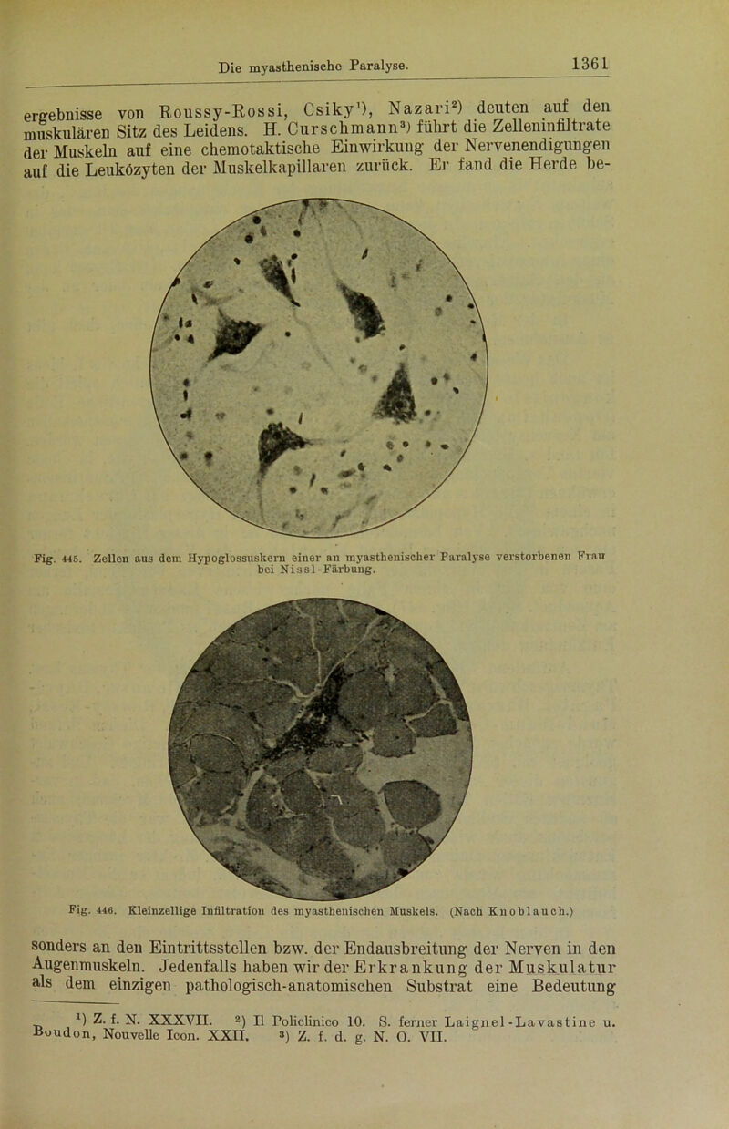 136 L ergebnisse von Roussy-Rossi, Csiky1), Nazan2) deuten auf den muskulären Sitz des Leidens. H. Curschmann3) führt die Zelleninfiltrate der Muskeln auf eine chemotaktische Einwirkung der Nervenendigungen auf die Leuközyten der Muskelkapillaren zurück. Er fand die Herde be- Fig. 446. Zellen aus dein Hypoglossuskern einer an myasthenischer Paralyse verstorbenen Frau bei Nissl-Färbung. Fig. 446. Kleinzellige Infiltration des myasthenischen Muskels. (Nach Knoblauch.) sonders an den Eintrittsstellen bzw. der Endausbreitung der Nerven in den Augenmuskeln. Jedenfalls haben wir der Erkrankung der Muskulatur als dem einzigen pathologisch-anatomischen Substrat eine Bedeutung J) Z. f. N. XXXVII. 2) II Policlinico 10. S. ferner Laignel -Lavastine u.