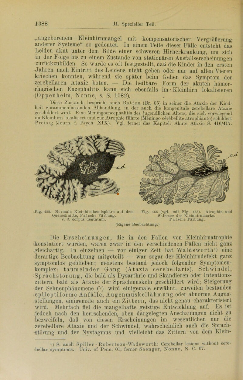 „angeborenem Kleinhirnmangel mit kompensatorischer Vergrößerung anderer Systeme“ so gedeutet. In einem Teile dieser Fälle entsteht das Leiden akut unter dem Bilde einer schweren Hirnerkrankung, um sich in der Folge bis zu einem Zustande von stationären Ausfallserscheinungen zurückzubilden. So wurde es oft festgestellt, daß die Kinder in den ersten Jahren nach Eintritt des Leidens nicht gehen oder nur auf allen Vieren kriechen konnten, während sie später beim Gehen das Symptom der zerebellaren Ataxie boten. — Die heilbare Form der akuten hämor- rhagischen Enzephalitis kann sich ebenfalls im •Kleinhirn lokalisieren (Oppenheim, Nonne, s. S. 1082). Diese Zustände bespricht auch Batten (Br. 05) in seiner die Ataxie der Kind- heit zusammenfassenden Abhandlung, in der auch die kongenitale zerebellare Ataxie geschildert wird. Eine Meningoencephalitis des jugendlichen Alters, die sich vorwiegend im Kleinhirn lokalisiert und zur Atrophie führte (Meningo cerebellite atrophiante) schildert Preisig (Journ. f. Psych. XIX). Vgl. ferner das Kapitel: Akute Ataxie S. 416/417. Fig. 455. Normale Kleinhirnhemisphäre auf dem Fig. 450 (vgl. mit Fig. 456). Atrophie und Querschnitte, Falsche Färbung. Sklerose des Kleinhirnmarks, c. <?. corpus dentatum. Pal sehe Färbung. (Eigene Beobachtung.) Die Erscheinungen, die in den Fällen von Kleinhirnatrophie konstatiert wurden, waren zwar in den verschiedenen Fällen nicht ganz gleichartig. In einzelnen — vor einiger Zeit hat Waldsworth1) eine derartige Beobachtung mitgeteilt — war sogar der Kleinhirndefekt ganz symptomlos geblieben; meistens bestand jedoch folgender Symptomen- komplex: taumelnder Gang (Ataxia cerebellaris), Schwindel, Sprachstörung, die bald als Dysarthrie und Skandieren oder Intentions- zittern, bald als Ataxie der Sprachmuskeln geschildert wird; Steigerung der Sehnenphänomene (?) wird einigemale erwähnt, zuweilen bestanden • epileptiforme Anfälle, Augenmuskellähmung oder abnorme Augen- stellungen, einigemale auch ein Zittern, das nicht genau charakterisiert wird. Mehrfach fiel die mangelhafte geistige Entwicklung auf. Es ist jedoch nach den herrschenden, oben dargelegten Anschauungen nicht zu bezweifeln, daß von diesen Erscheinungen im wesentlichen nur die zerebellare Ataxie und der Schwindel, wahrscheinlich auch die Sprach- störung und der Nystagmus und vielleicht das Zittern von dem Klein- i) 8. auch Spillcr - Robertson-Wadsworth: Cerebcllar lesions without cere- •bellar Symptoms. Univ. of Penn. 01, ferner Saenger, Nonne, X. C. 07.